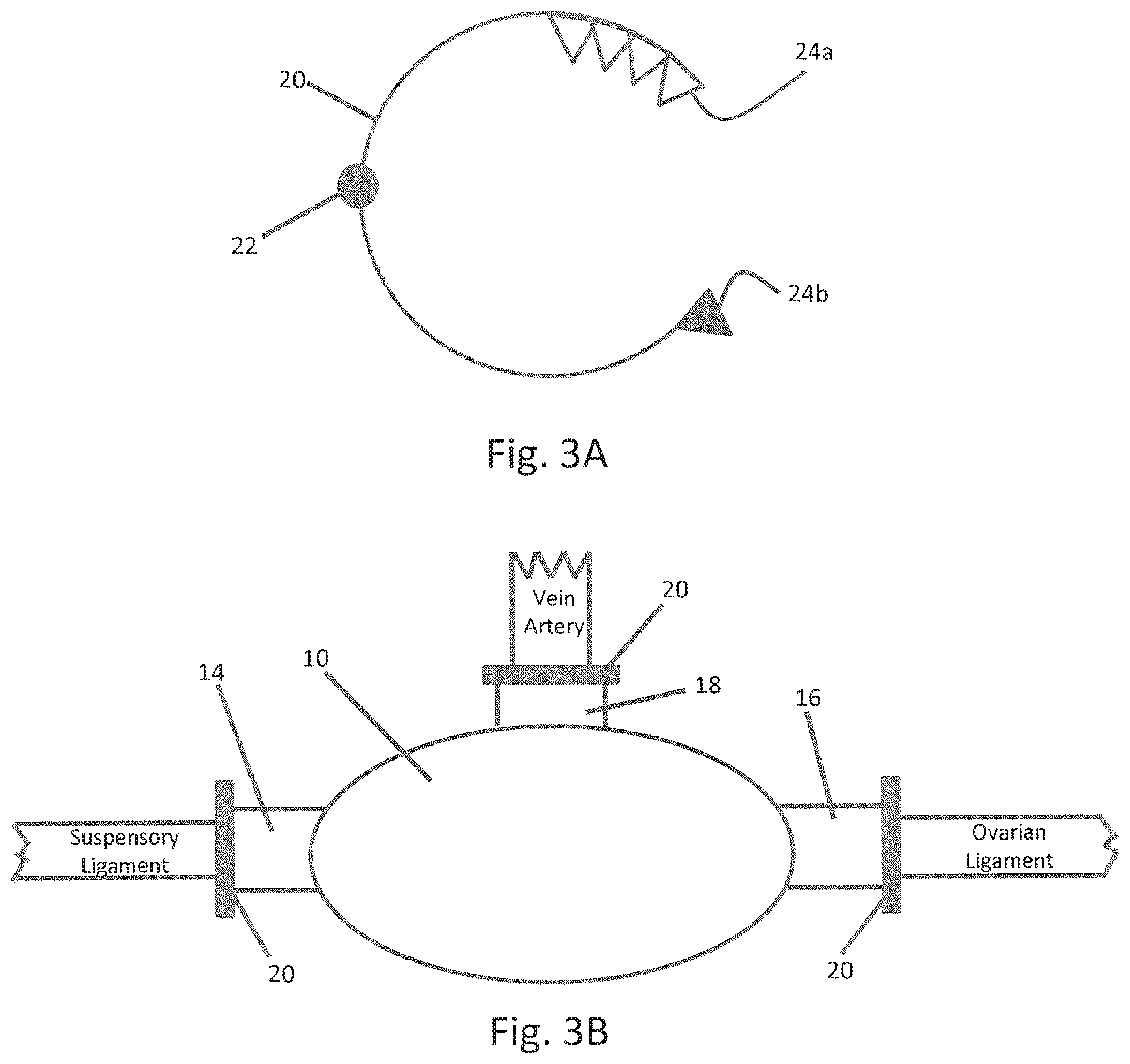 Patent US11793548 Figure 3 – Organ enclosures for inhibiting tumor invasion and detecting organ pathology