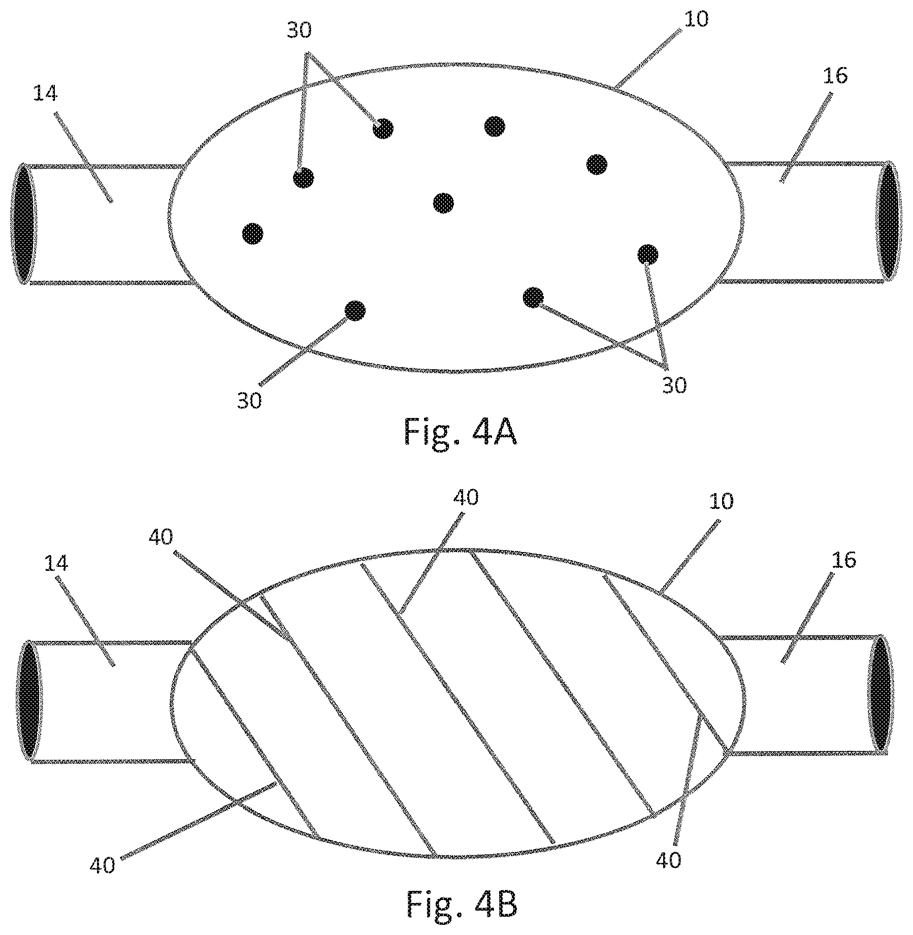 Patent US11793548 Figure 4 – Organ enclosures for inhibiting tumor invasion and detecting organ pathology