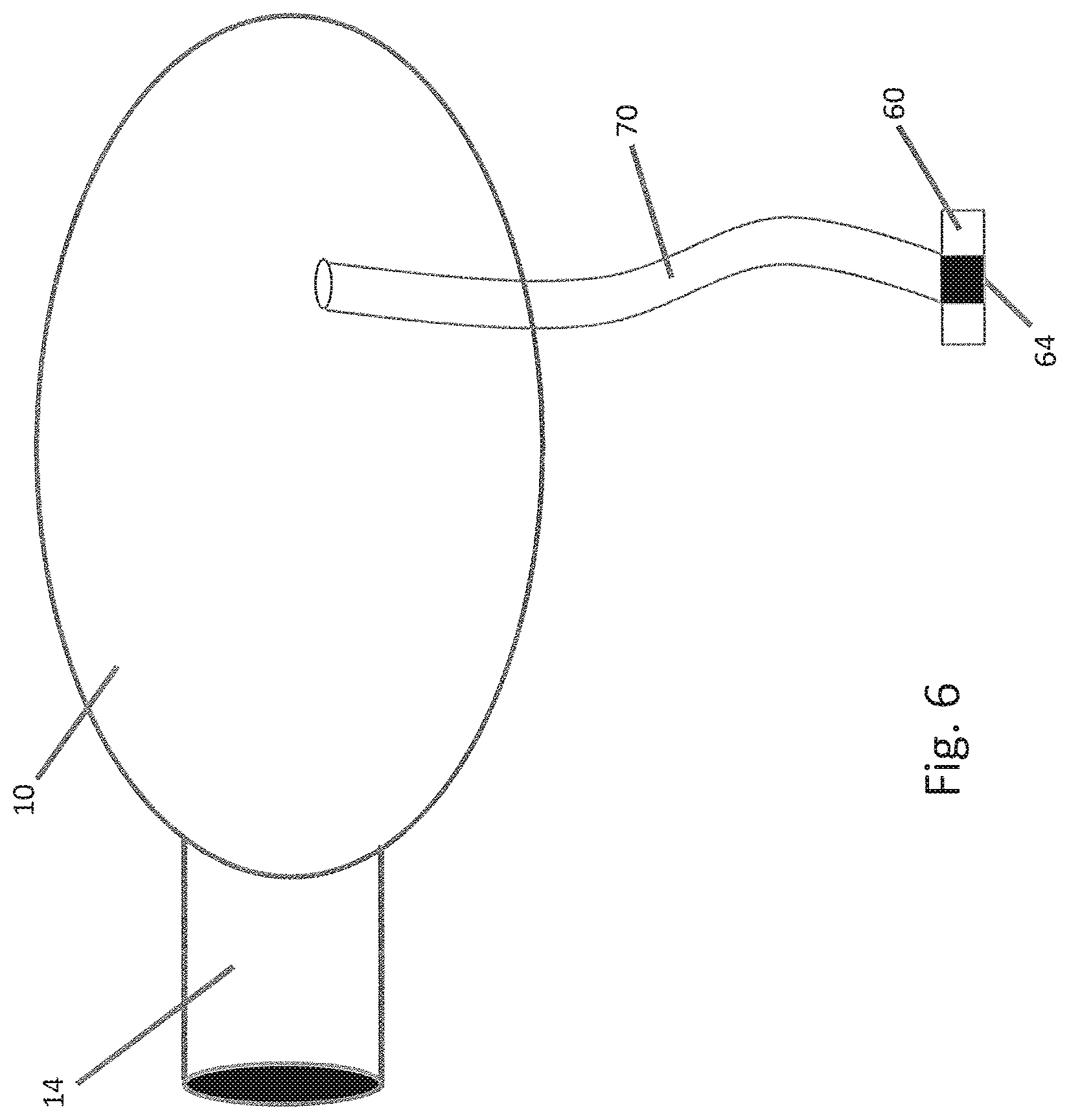 Patent US11793548 Figure 9 – Organ enclosures for inhibiting tumor invasion and detecting organ pathology