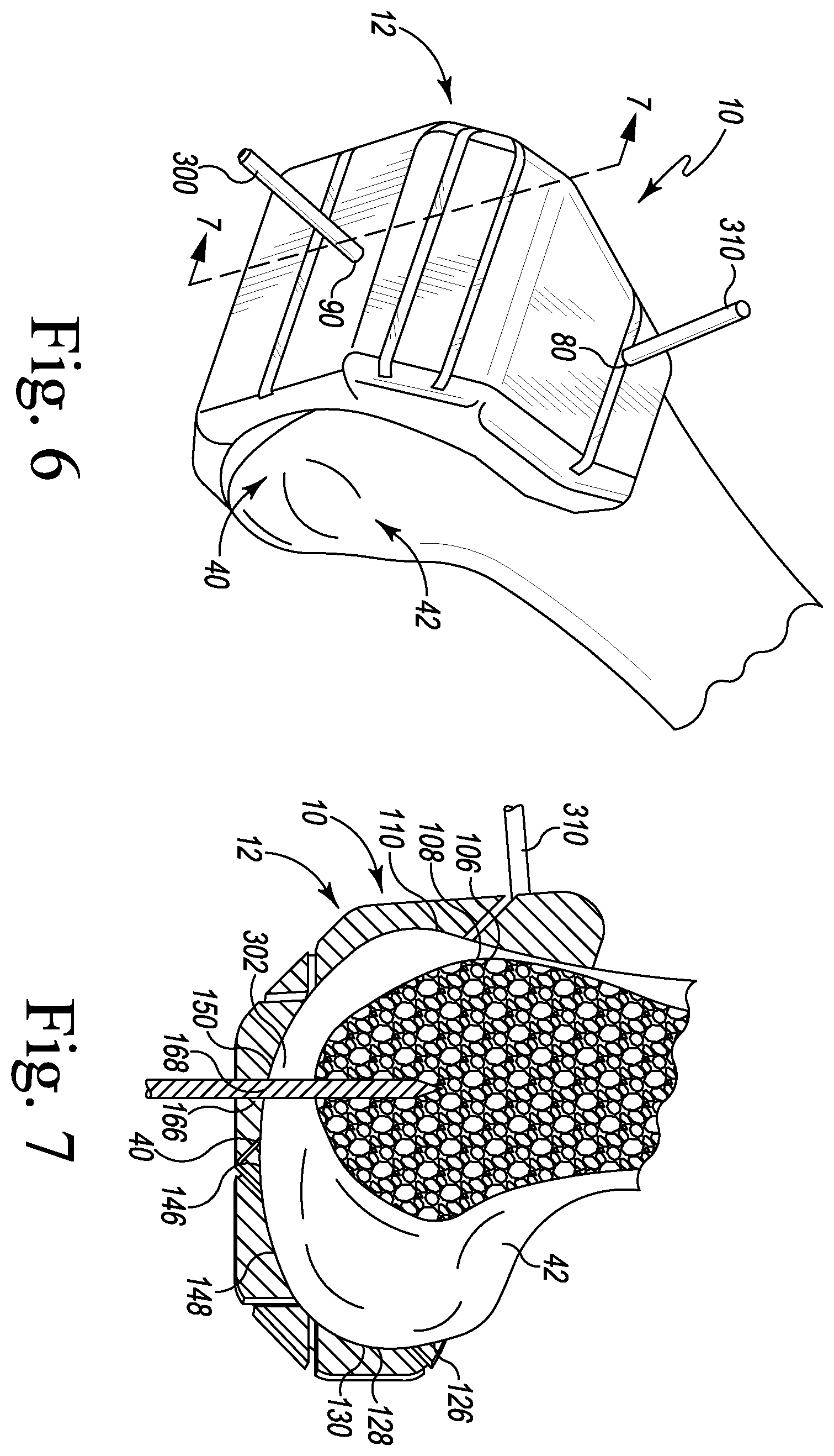 Patent US11793549 Figure 4 – Customized patient-specific orthopaedic surgical instrument and method for preparing a patient's femur