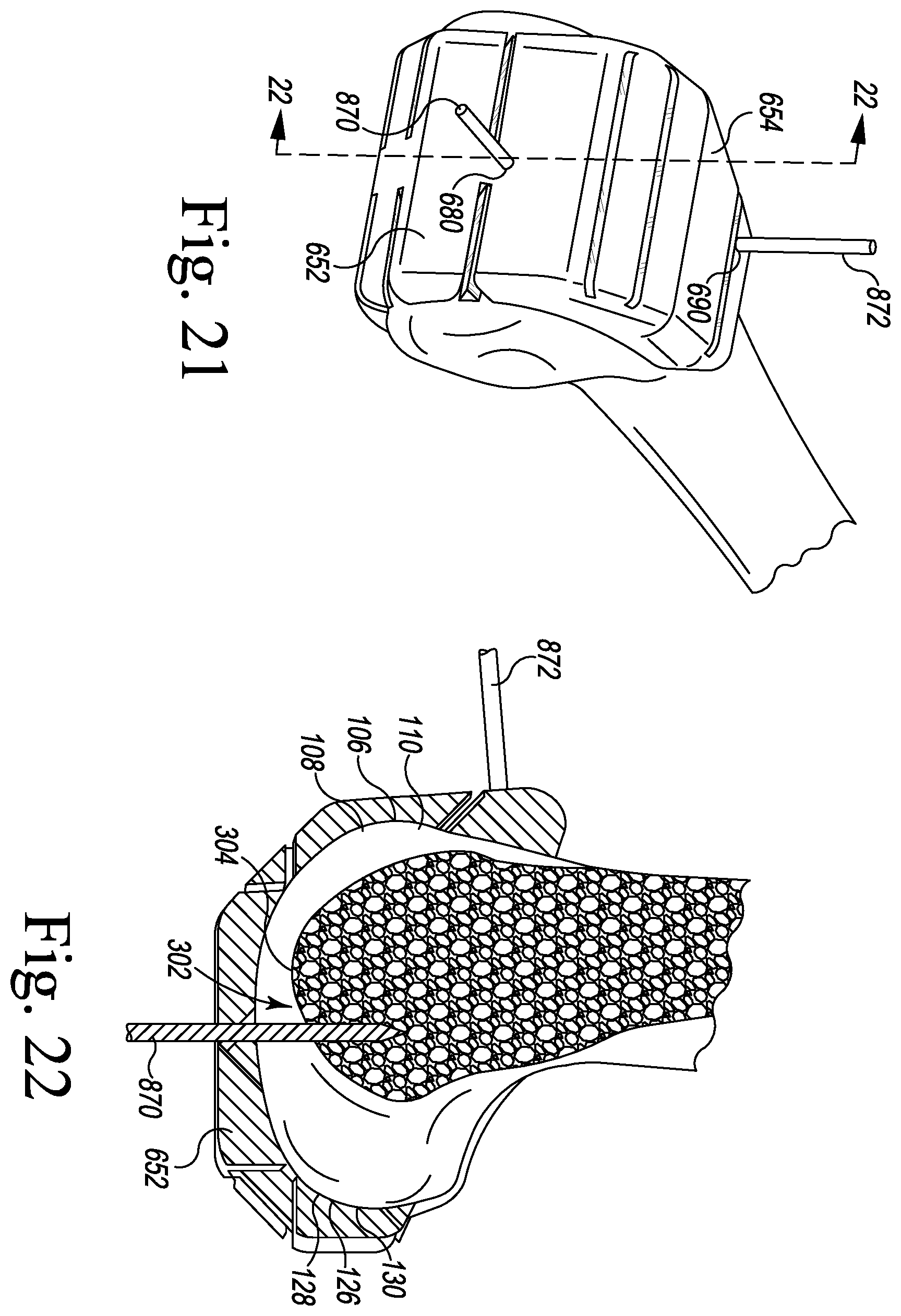 Patent US11793549 Figure 12 – Customized patient-specific orthopaedic surgical instrument and method for preparing a patient's femur