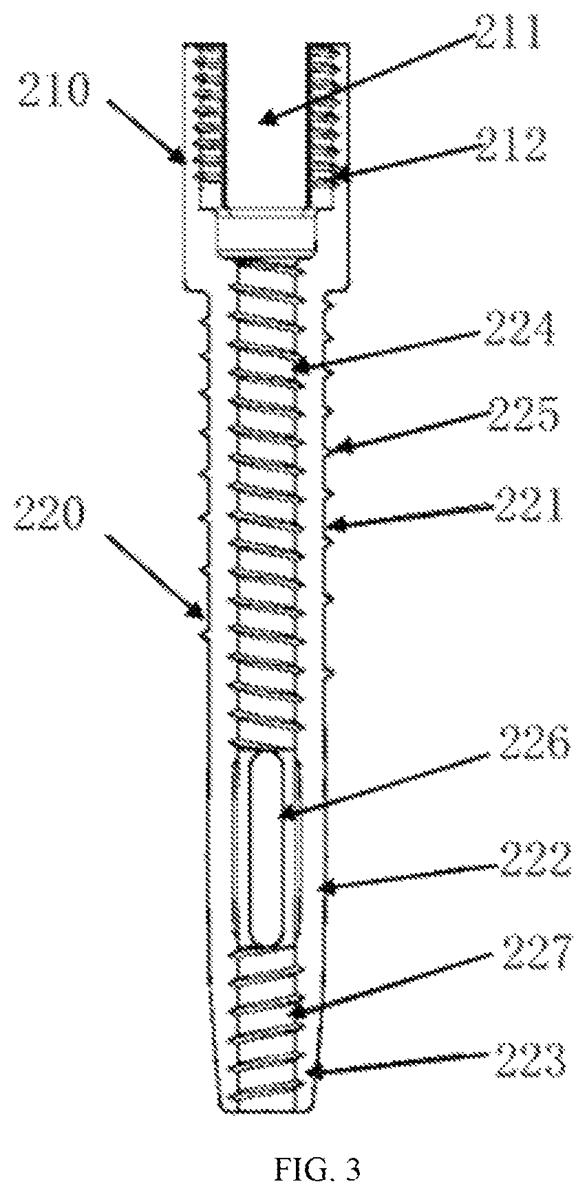 Patent US11793550 Figure 3 – Claw-shaped pedicle screw fastener for osteoporosis