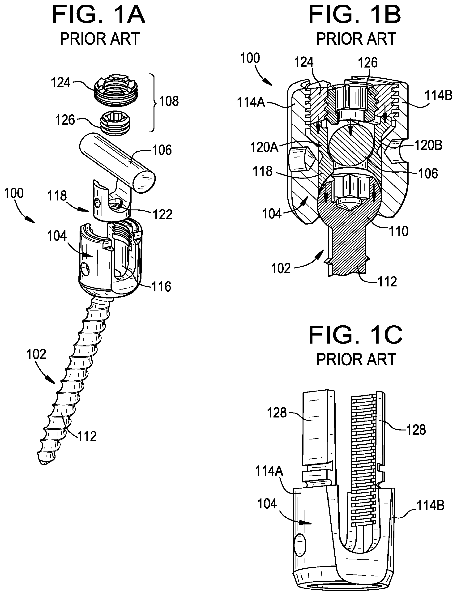 Patent US11793551 Figure 1 – Multipoint fixation implants