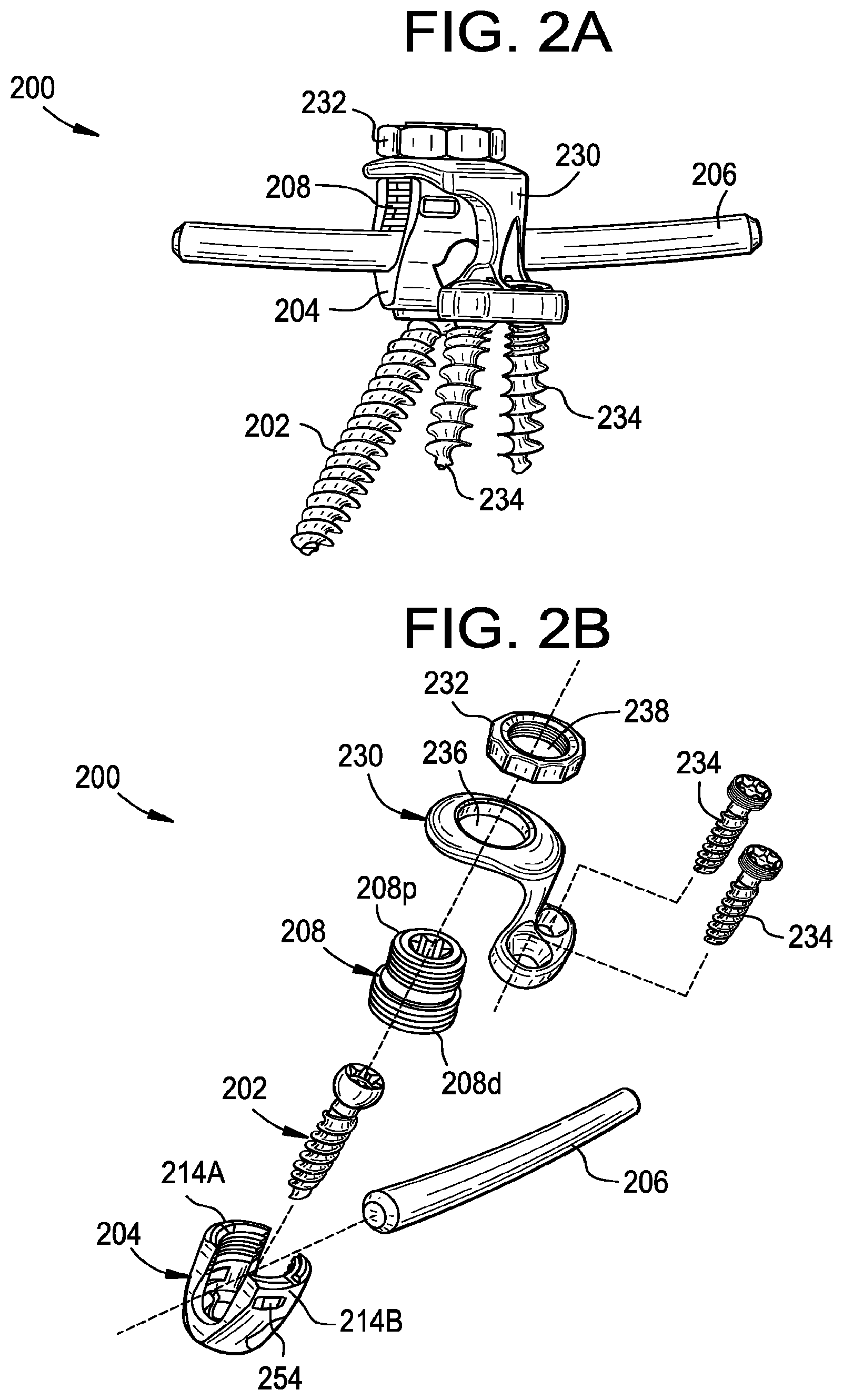 Patent US11793551 Figure 2 – Multipoint fixation implants