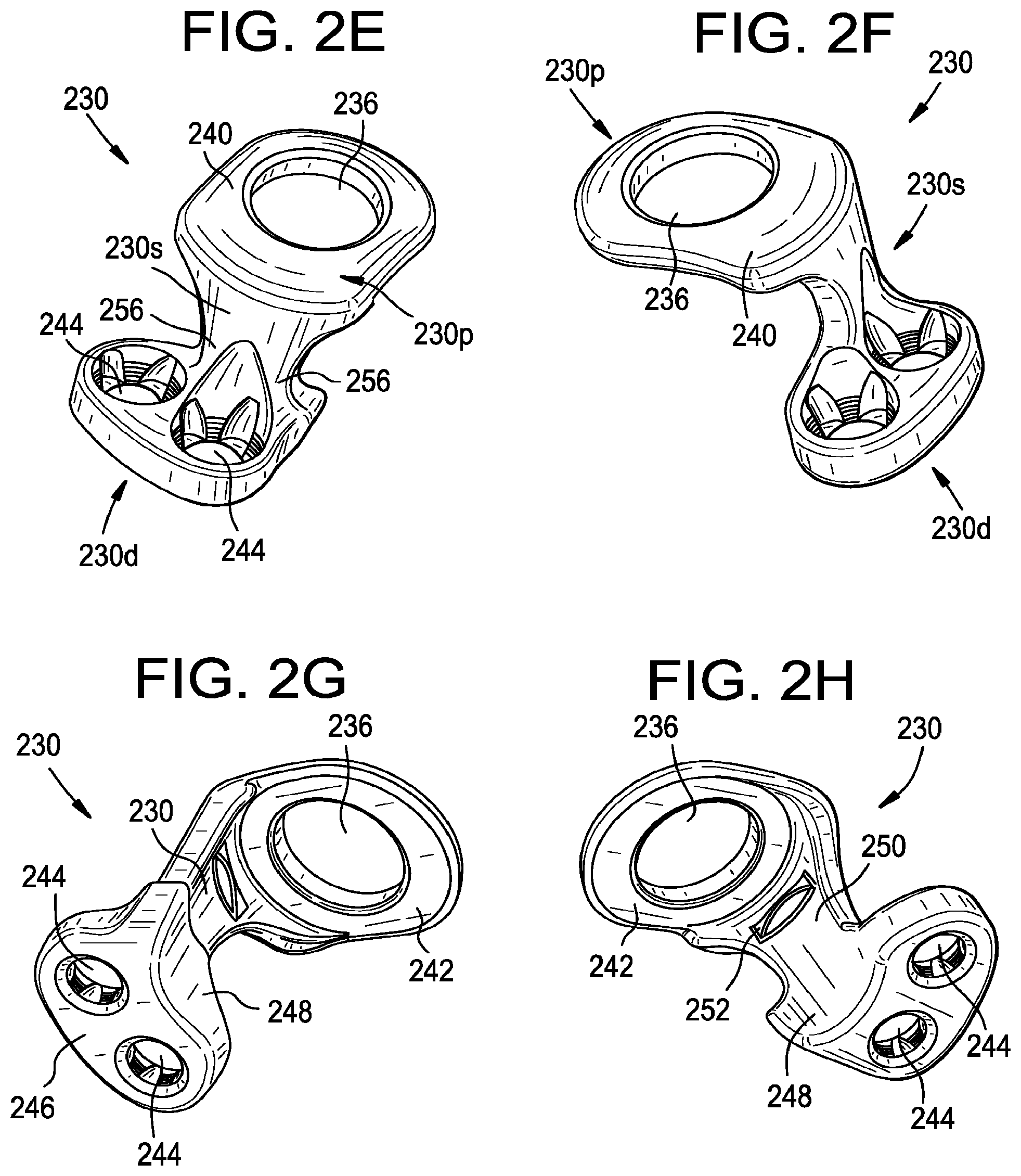 Patent US11793551 Figure 4 – Multipoint fixation implants