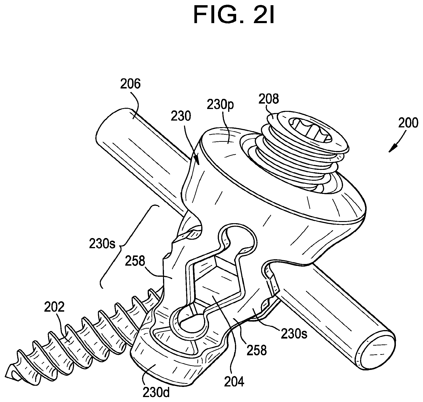 Patent US11793551 Figure 5 – Multipoint fixation implants