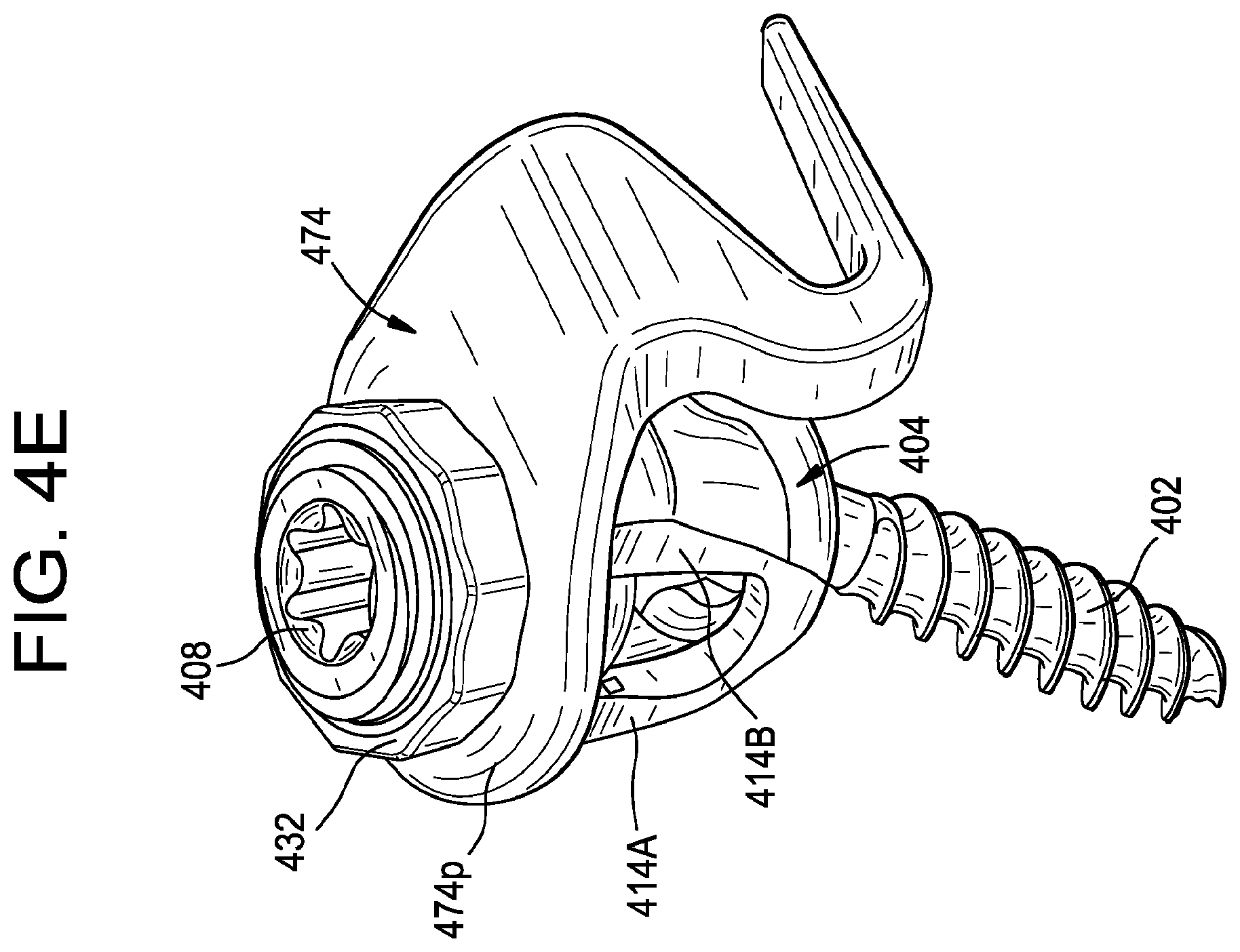 Patent US11793551 Figure 13 – Multipoint fixation implants