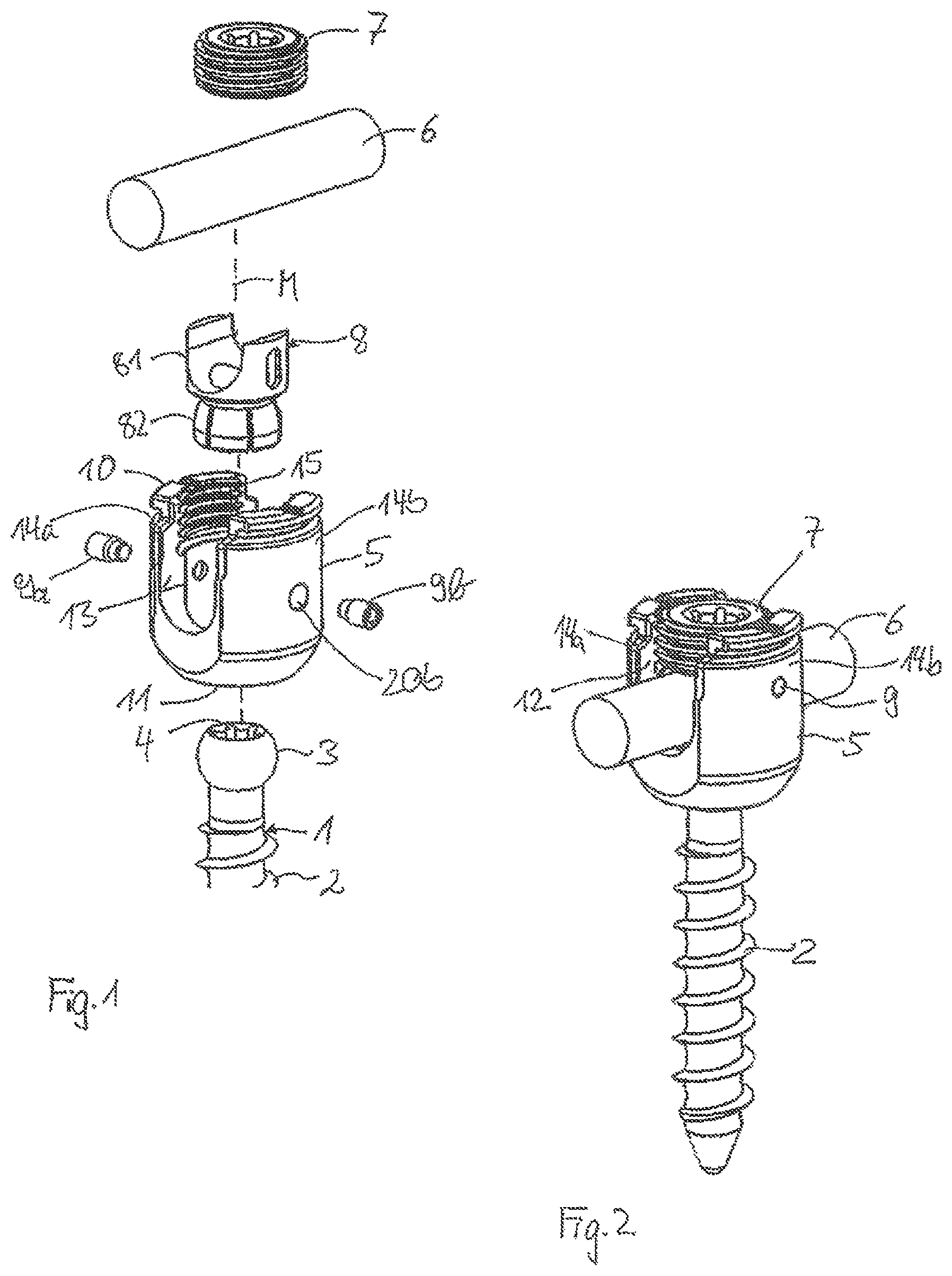 Patent US11793552 — Receiving part for receiving a rod for coupling the rod to a bone anchoring element and a bone anchoring device with such a receiving part — Figure 1