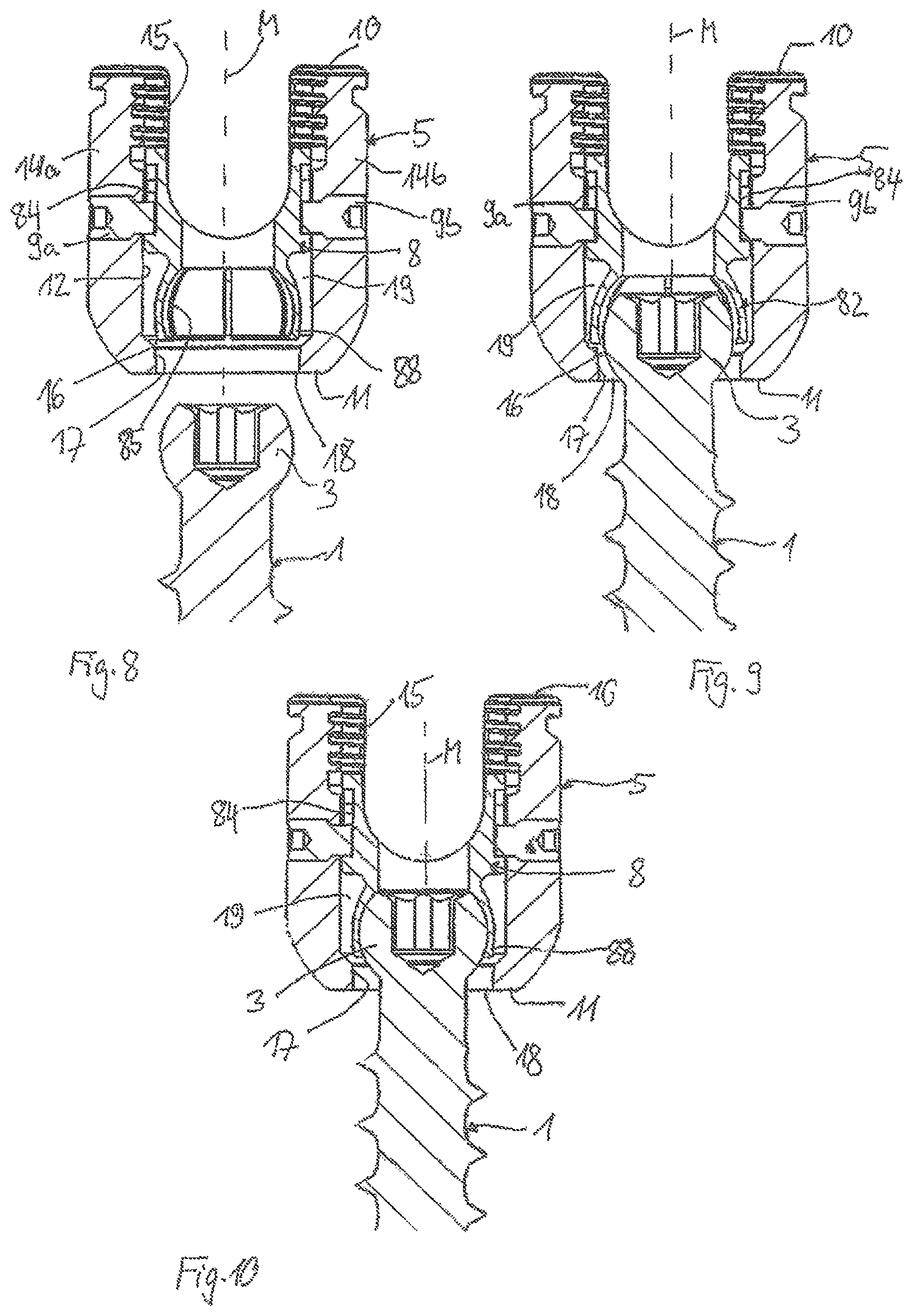 Patent US11793552 Figure 3 – Receiving part for receiving a rod for coupling the rod to a bone anchoring element and a bone anchoring device with such a receiving part