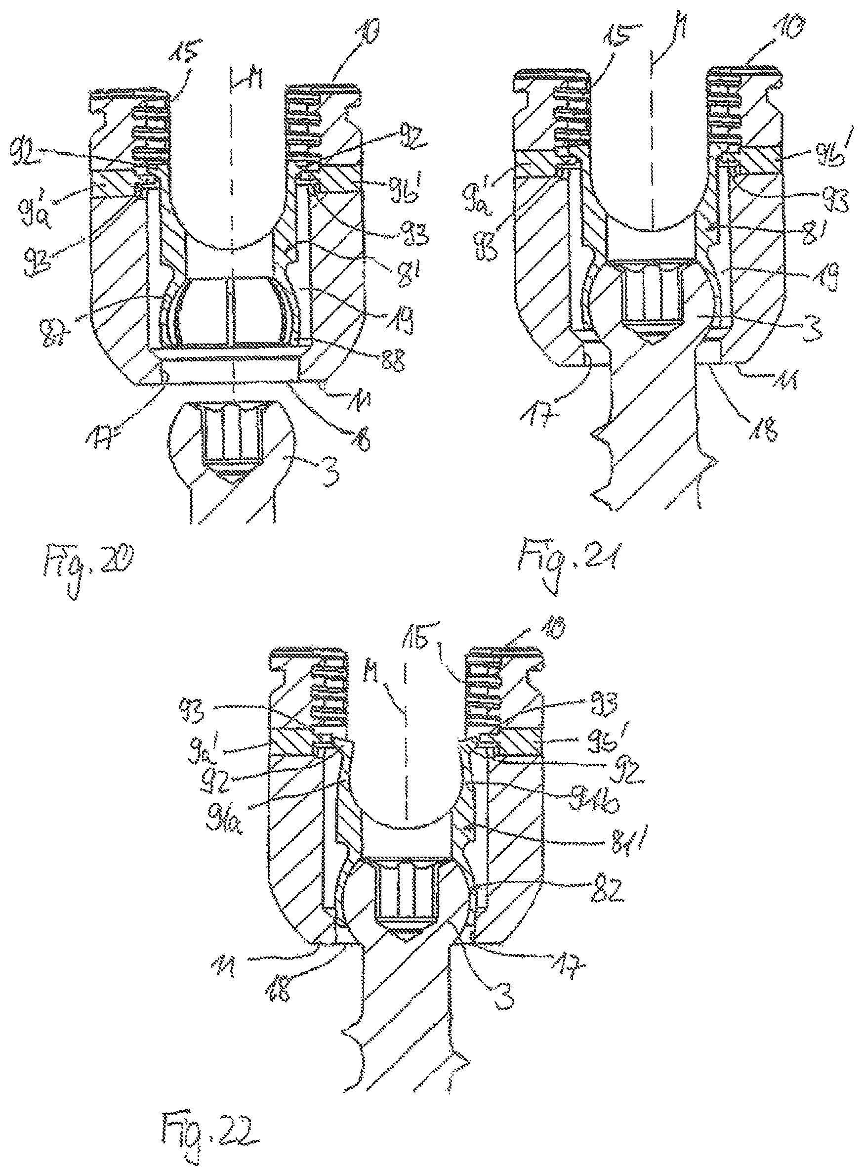 Patent US11793552 Figure 7 – Receiving part for receiving a rod for coupling the rod to a bone anchoring element and a bone anchoring device with such a receiving part