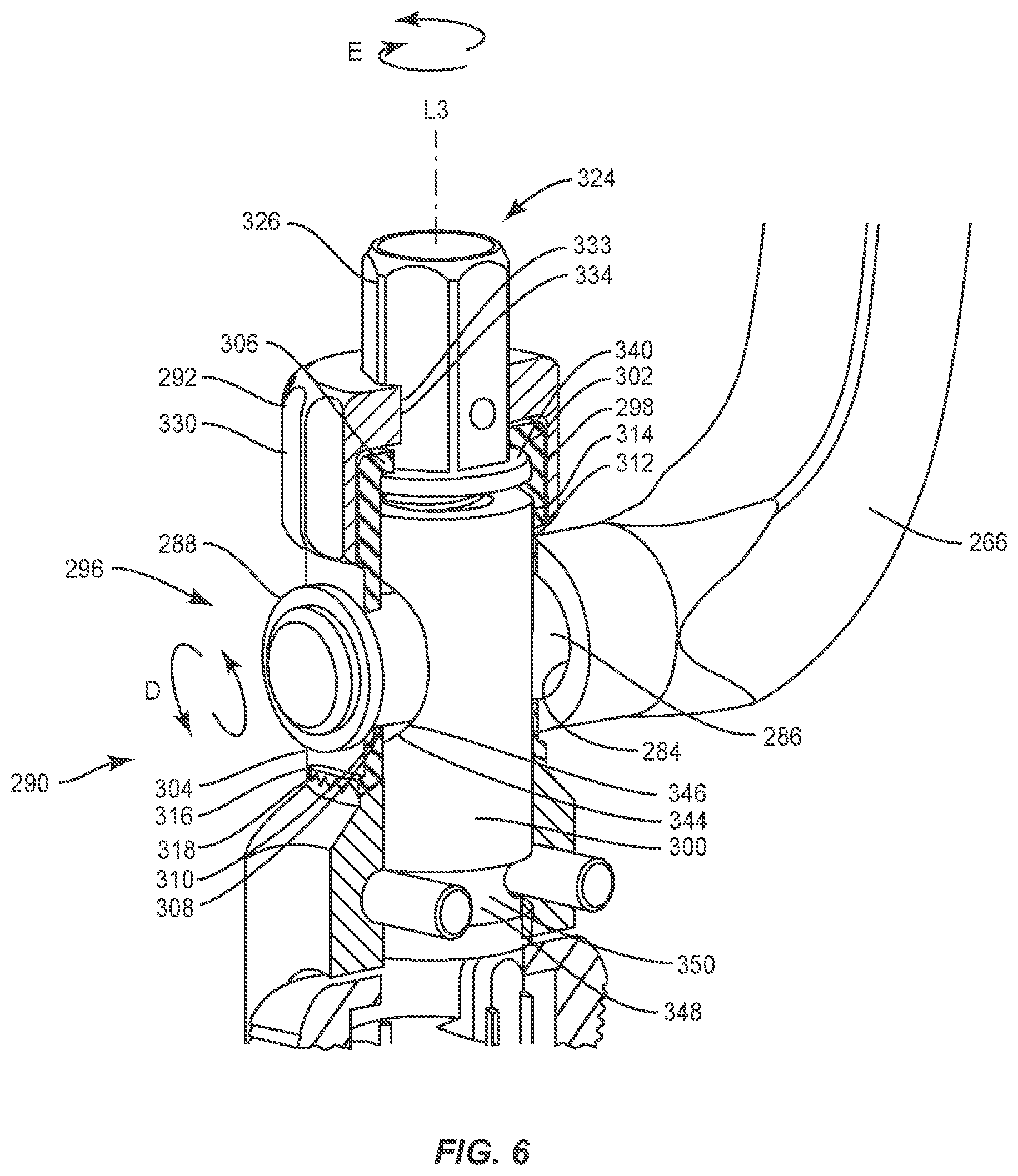 Patent US11793555 Figure 4 – Spinal correction system and method