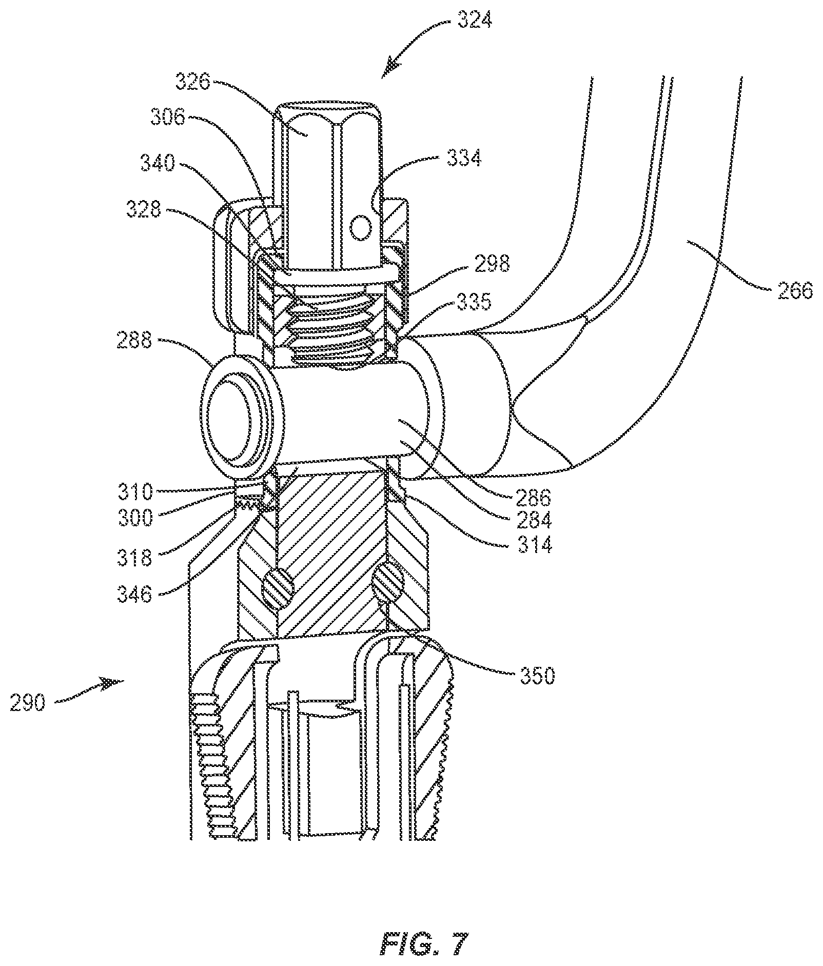 Patent US11793555 Figure 5 – Spinal correction system and method