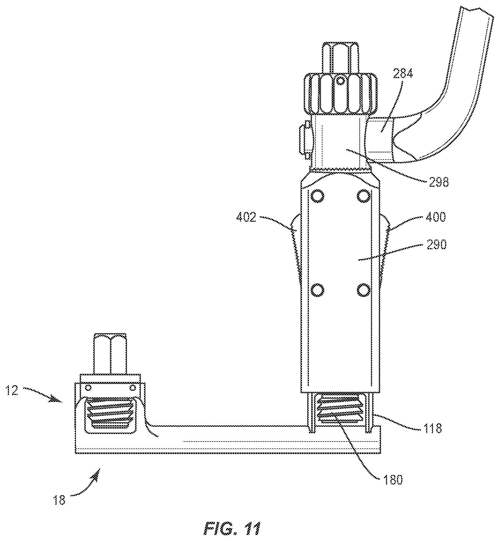 Patent US11793555 Figure 9 – Spinal correction system and method