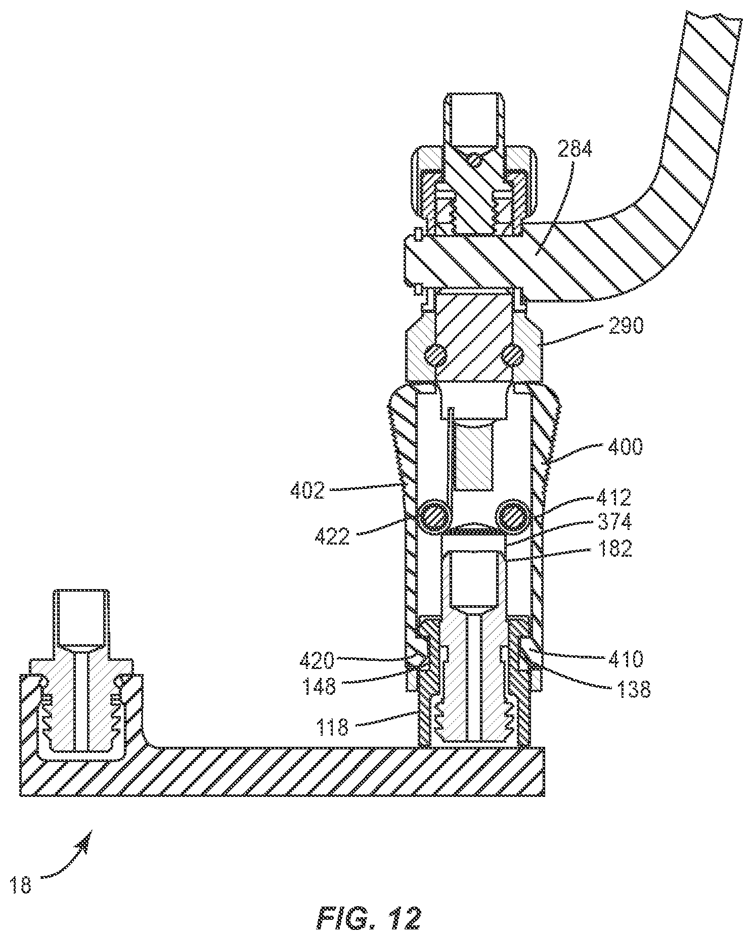 Patent US11793555 Figure 10 – Spinal correction system and method