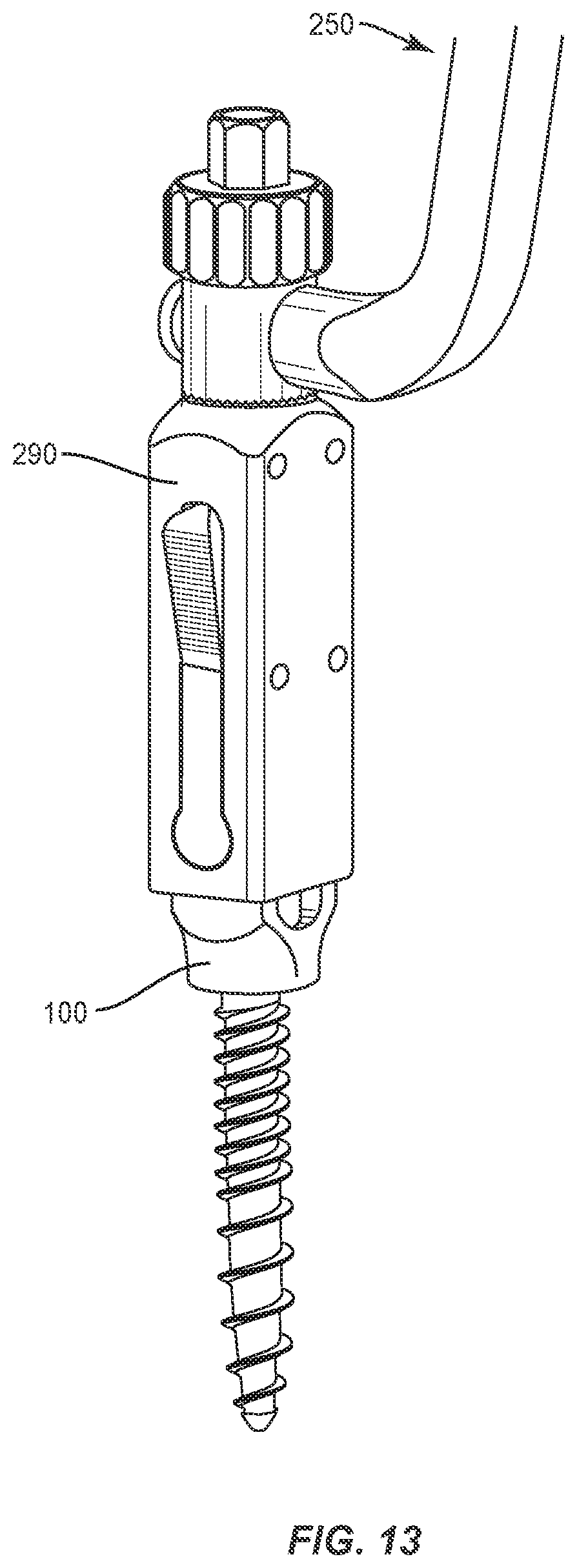 Patent US11793555 Figure 11 – Spinal correction system and method