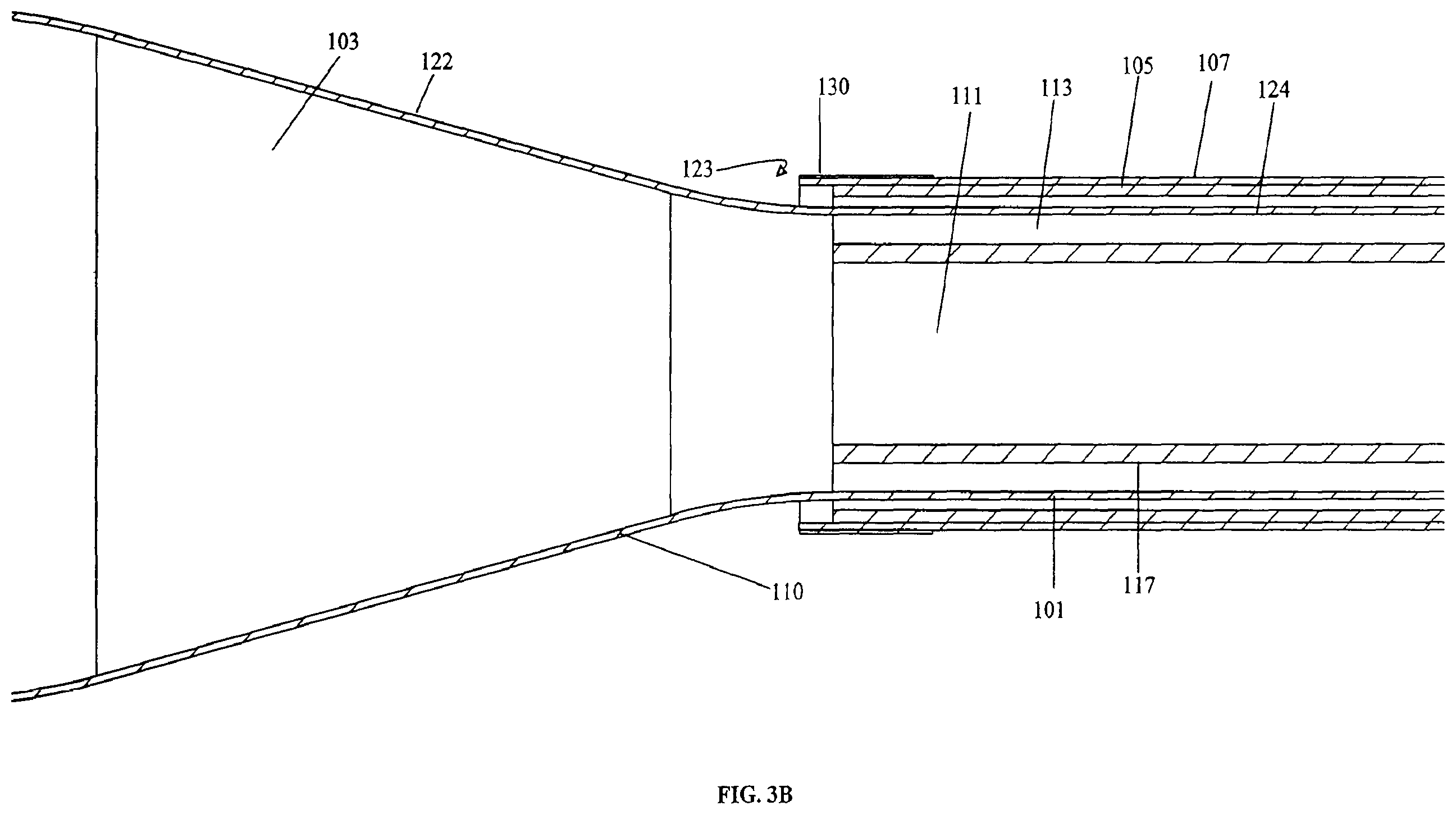 Patent US11793556 Figure 5 – Systems and methods for internal bone fixation