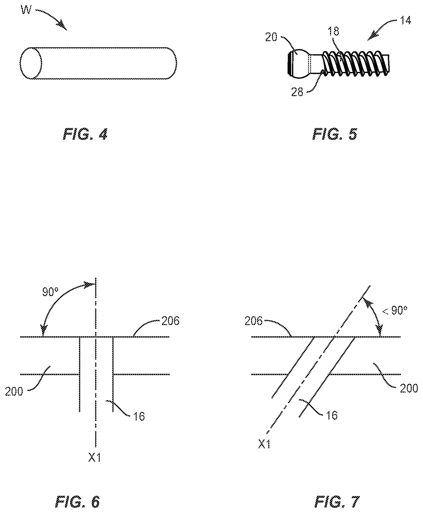 Patent US11793557 Figure 3 – System and method of manufacture for spinal implant