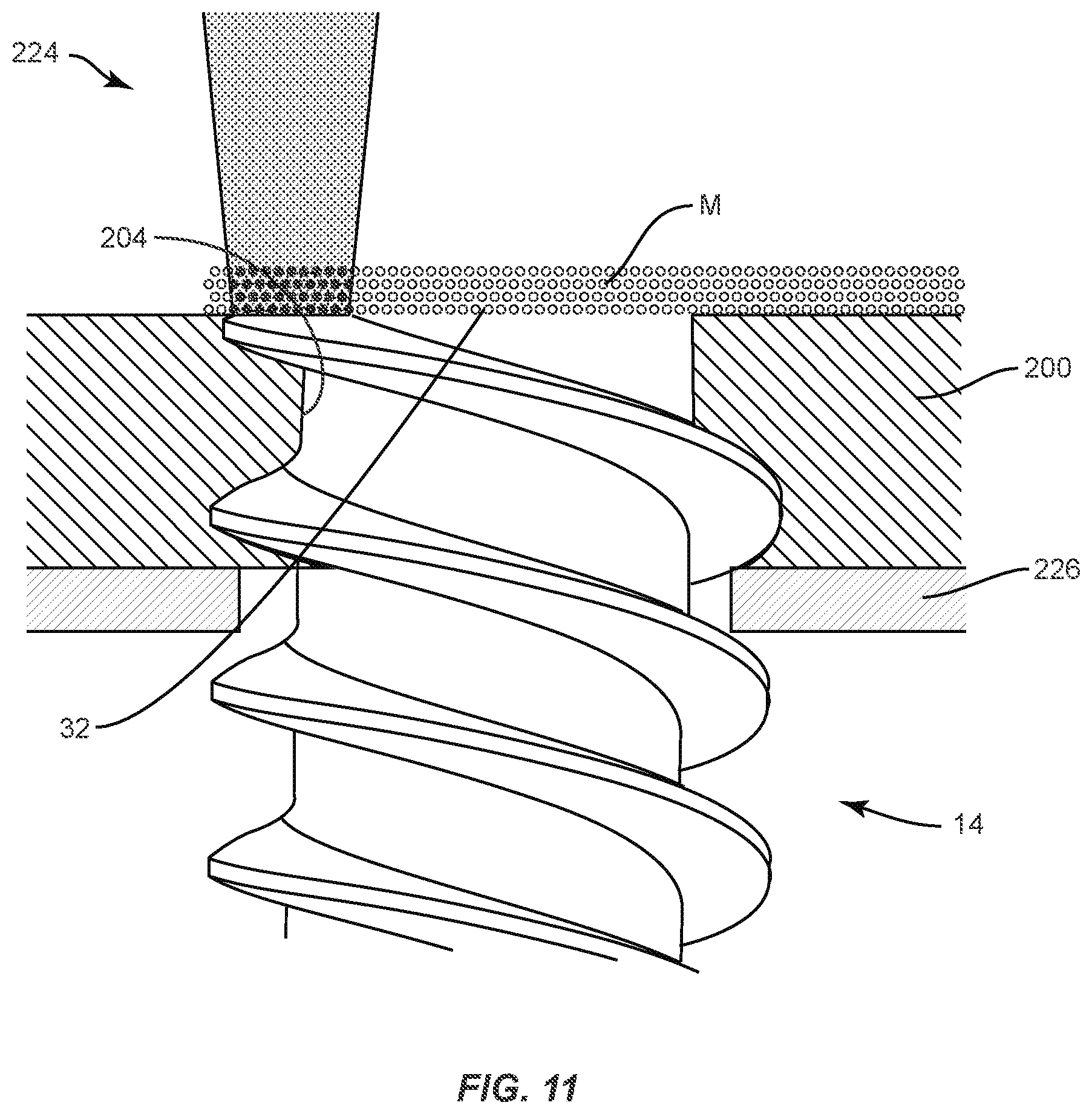 Patent US11793557 Figure 7 – System and method of manufacture for spinal implant