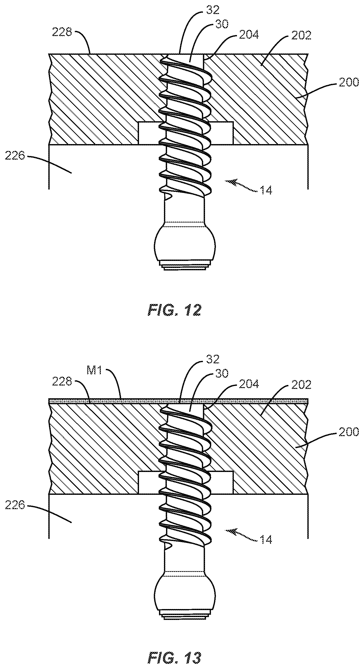Patent US11793557 Figure 8 – System and method of manufacture for spinal implant