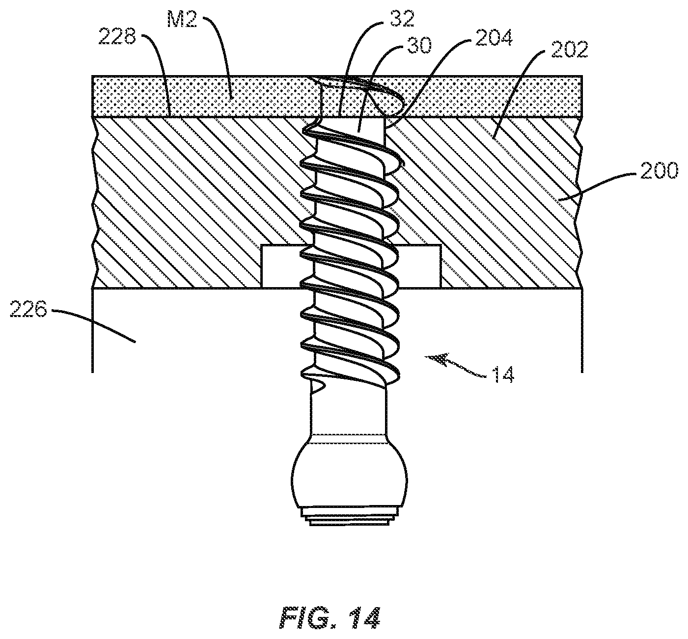 Patent US11793557 Figure 9 – System and method of manufacture for spinal implant
