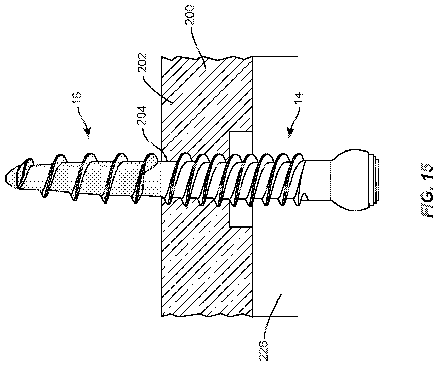 Patent US11793557 Figure 10 – System and method of manufacture for spinal implant