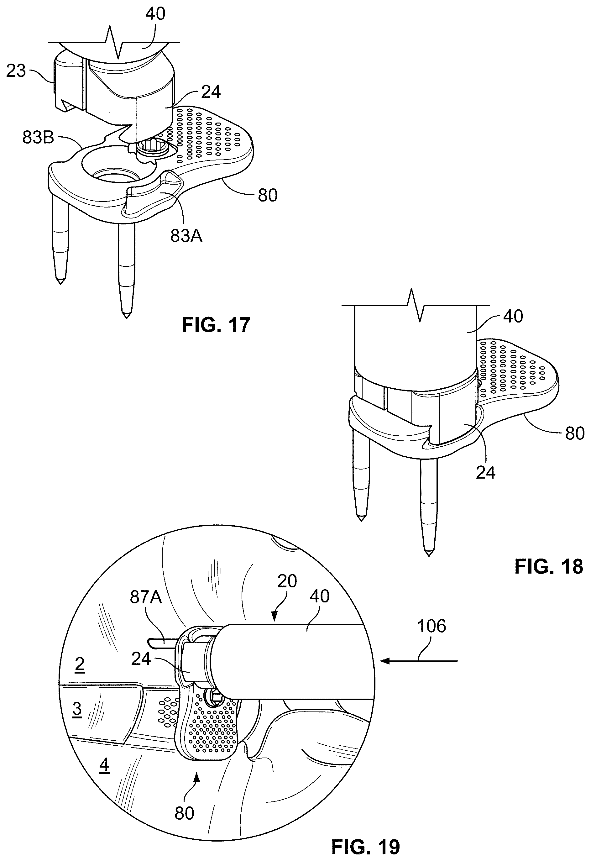Patent US11793558 Figure 6 – All in one plate holder and spring loaded awl