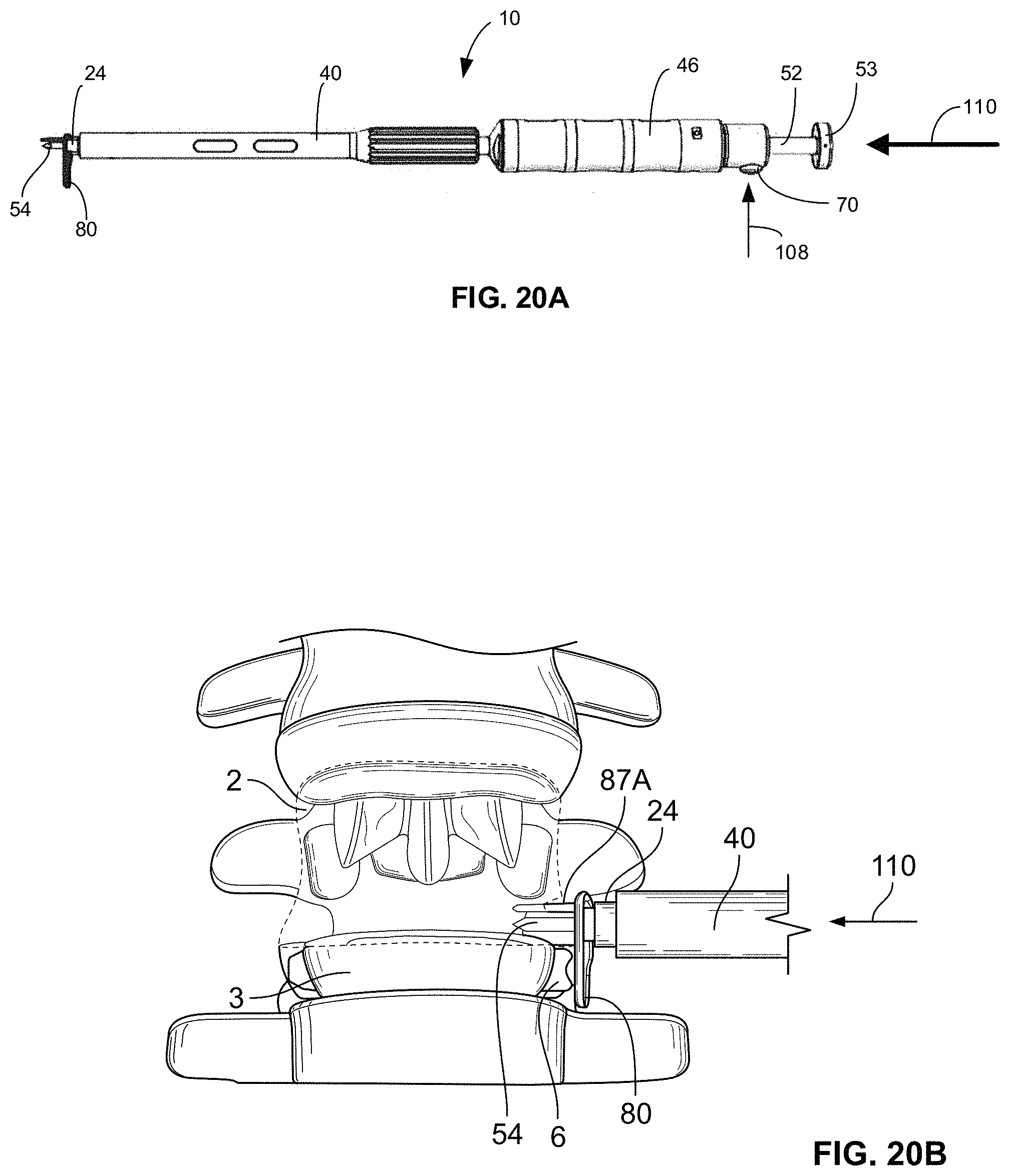 Patent US11793558 Figure 7 – All in one plate holder and spring loaded awl