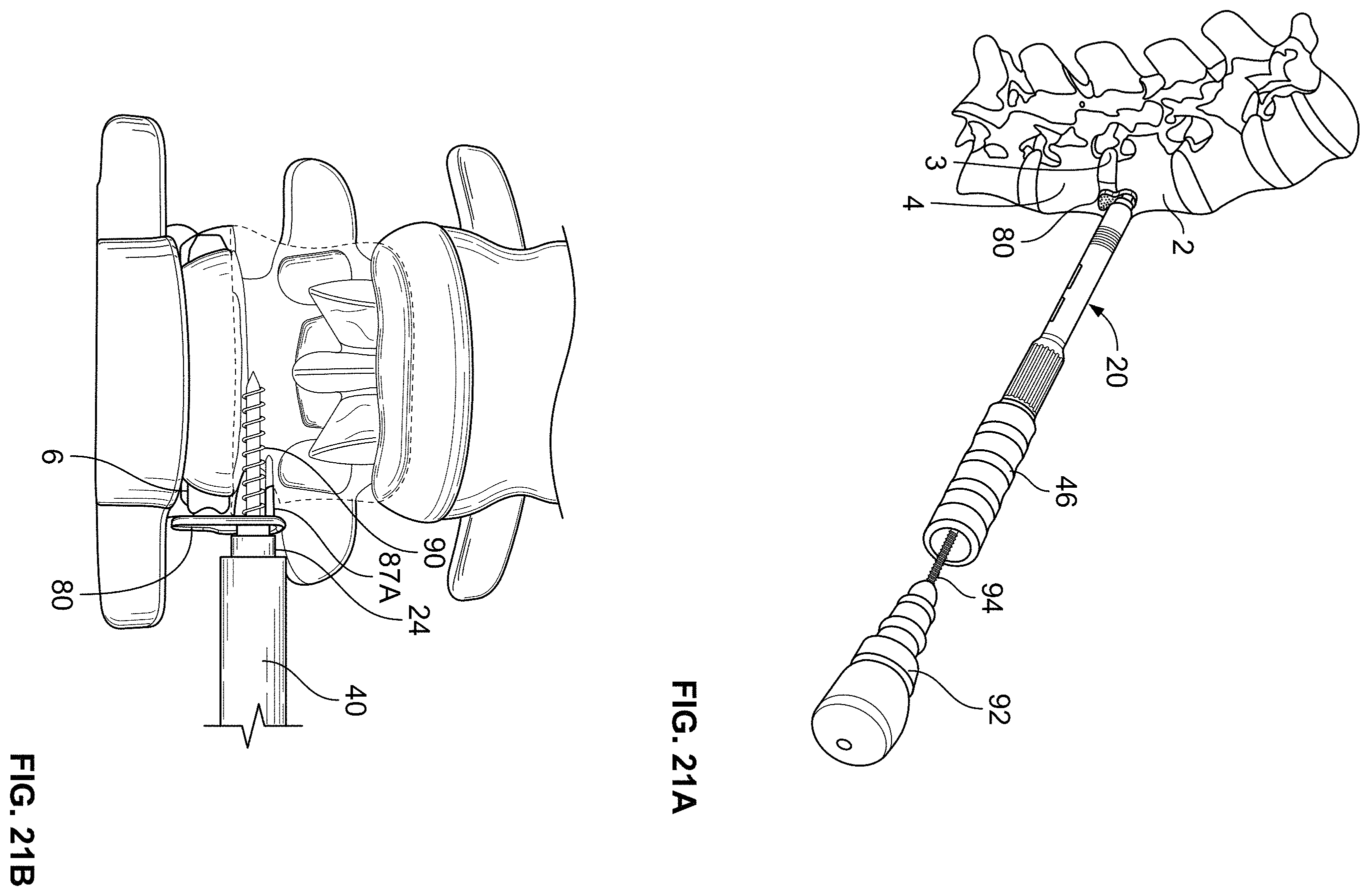 Patent US11793558 Figure 8 – All in one plate holder and spring loaded awl