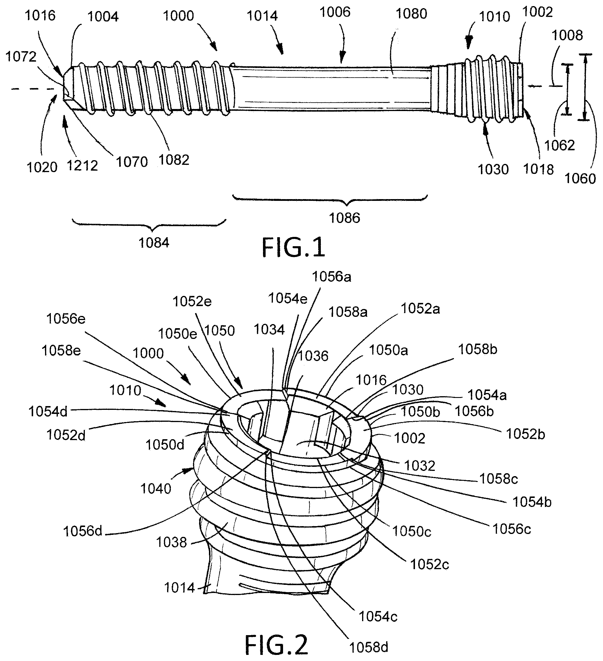 Patent US11793559 Figure 1 – Removable orthopedic screws