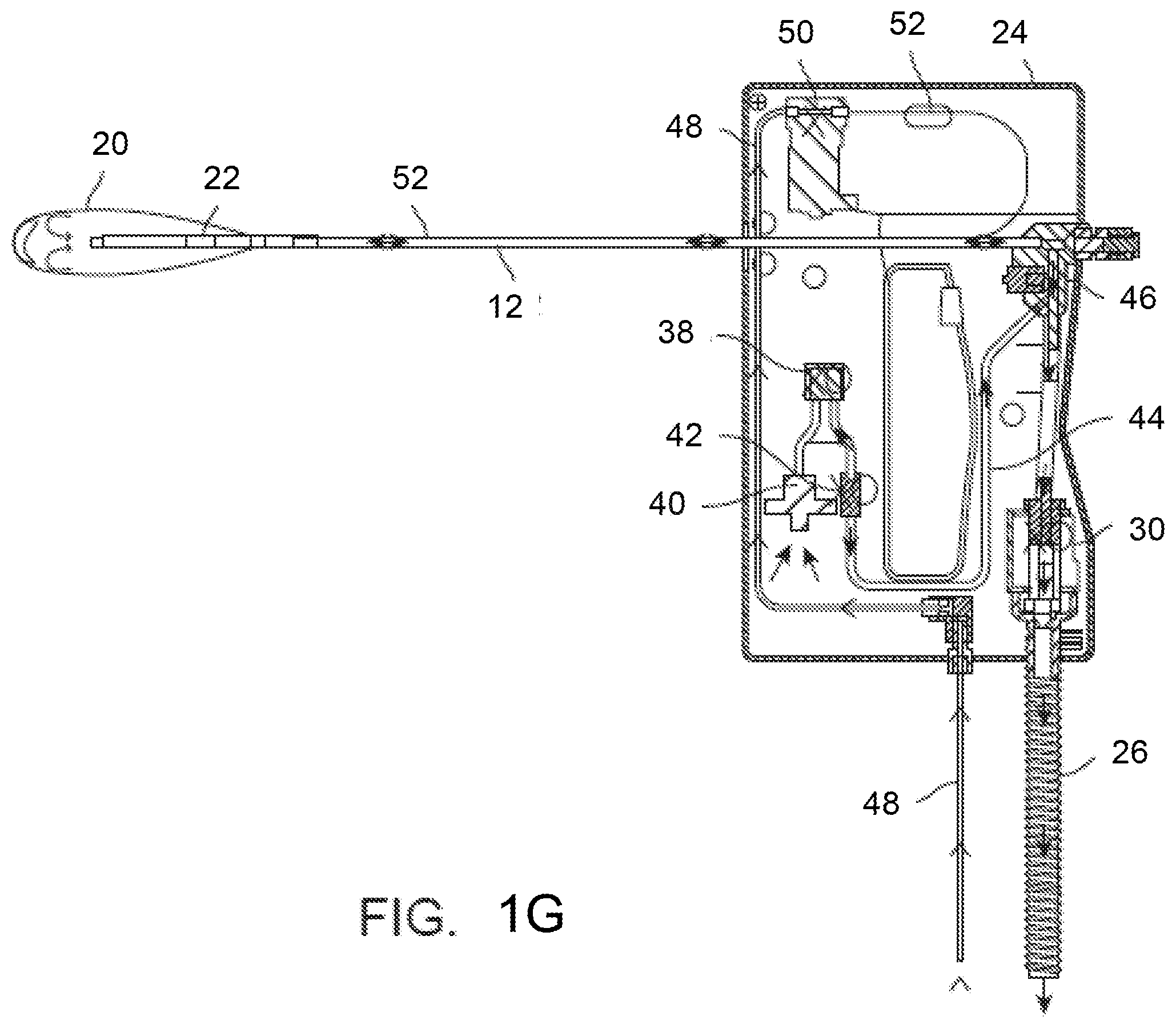 Patent US11793561 Figure 5 – Apparatus and methods for regulating cryogenic treatment