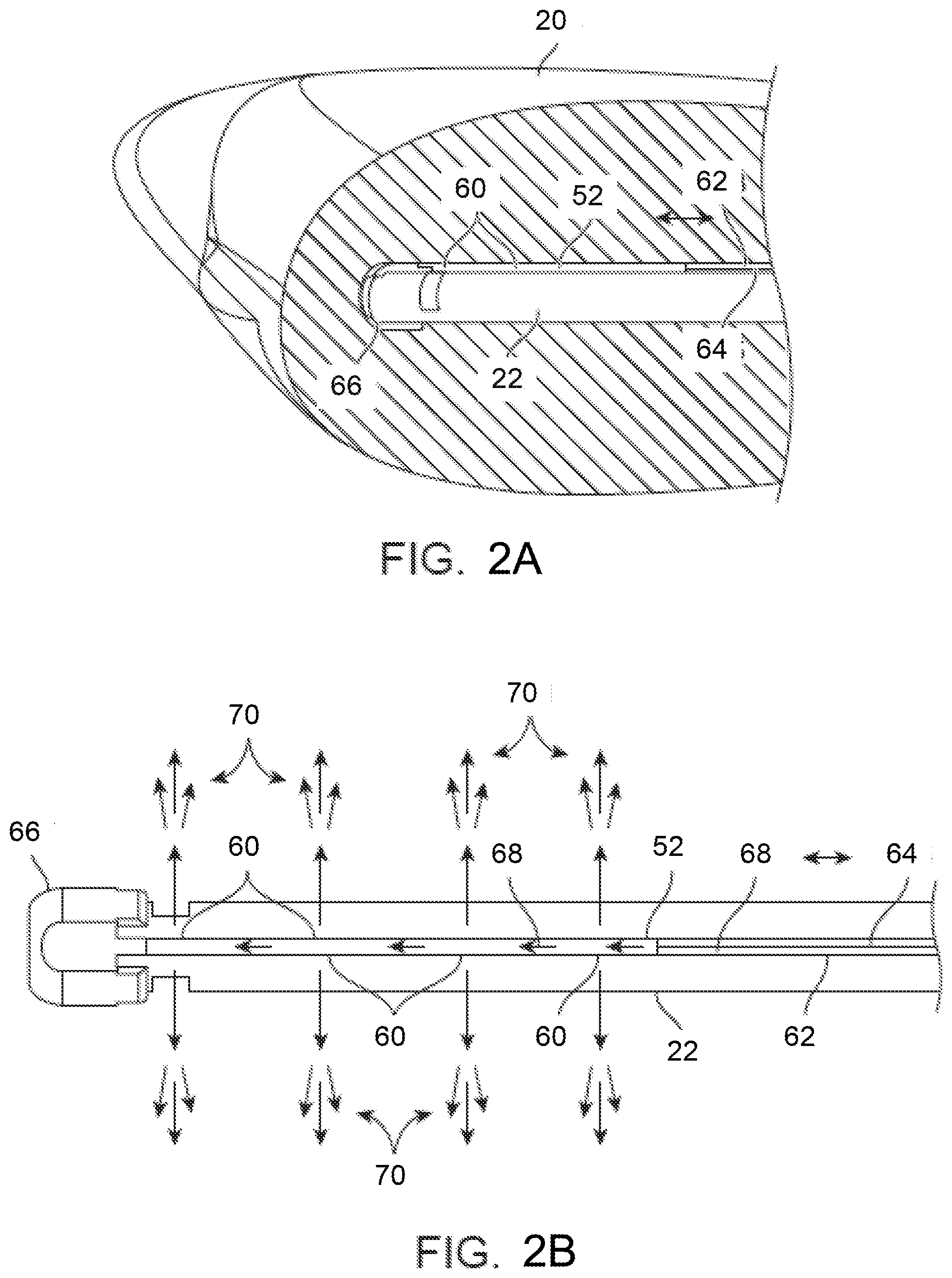 Patent US11793561 Figure 6 – Apparatus and methods for regulating cryogenic treatment