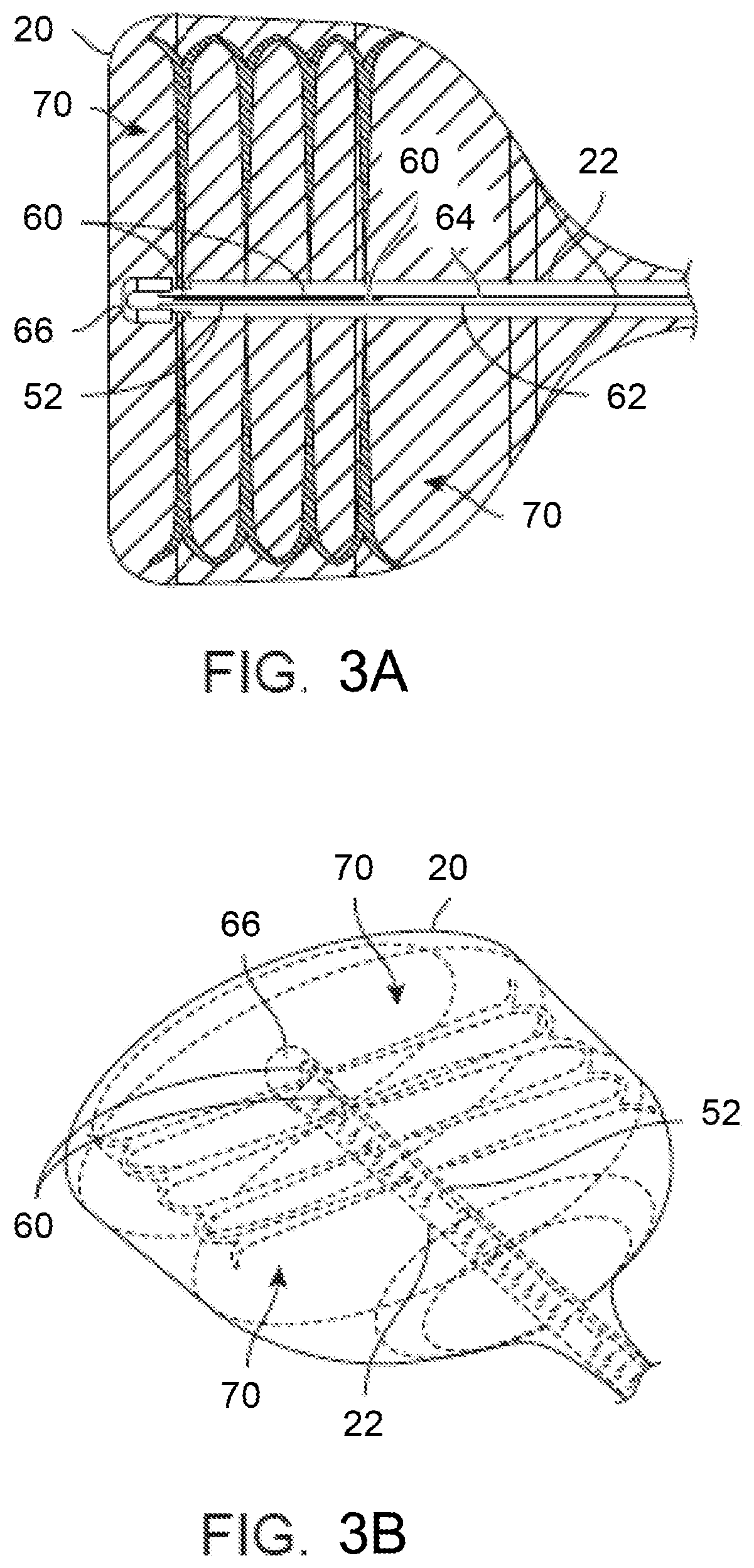 Patent US11793561 Figure 7 – Apparatus and methods for regulating cryogenic treatment