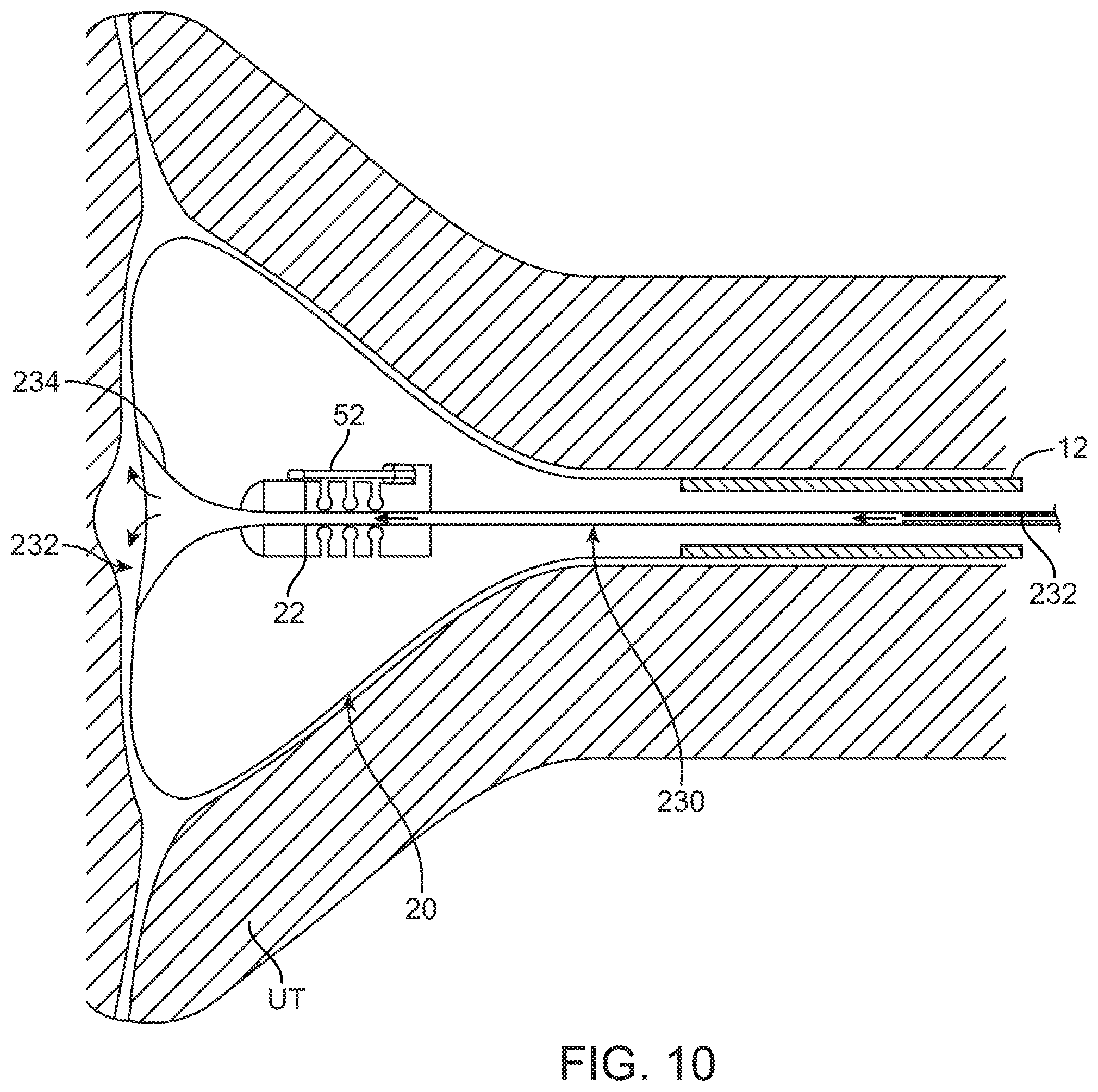 Patent US11793561 Figure 15 – Apparatus and methods for regulating cryogenic treatment