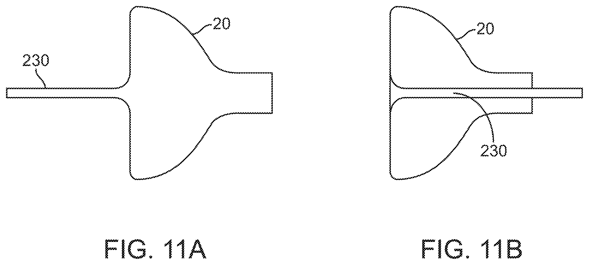 Patent US11793561 Figure 16 – Apparatus and methods for regulating cryogenic treatment