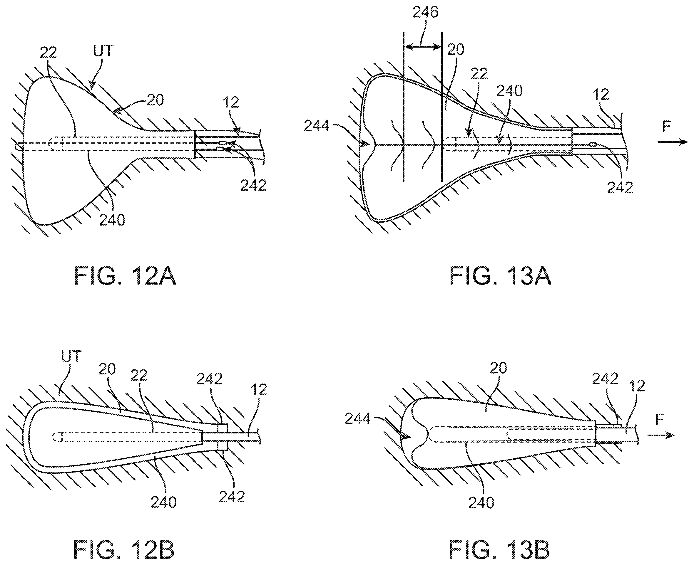 Patent US11793561 Figure 17 – Apparatus and methods for regulating cryogenic treatment