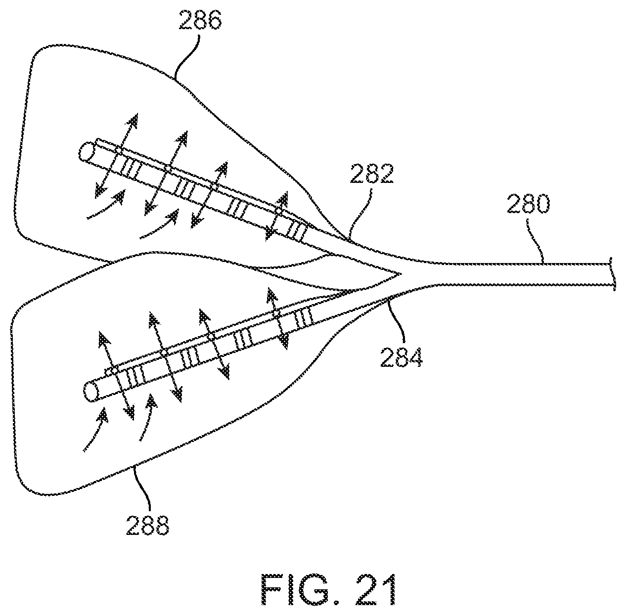 Patent US11793561 Figure 20 – Apparatus and methods for regulating cryogenic treatment