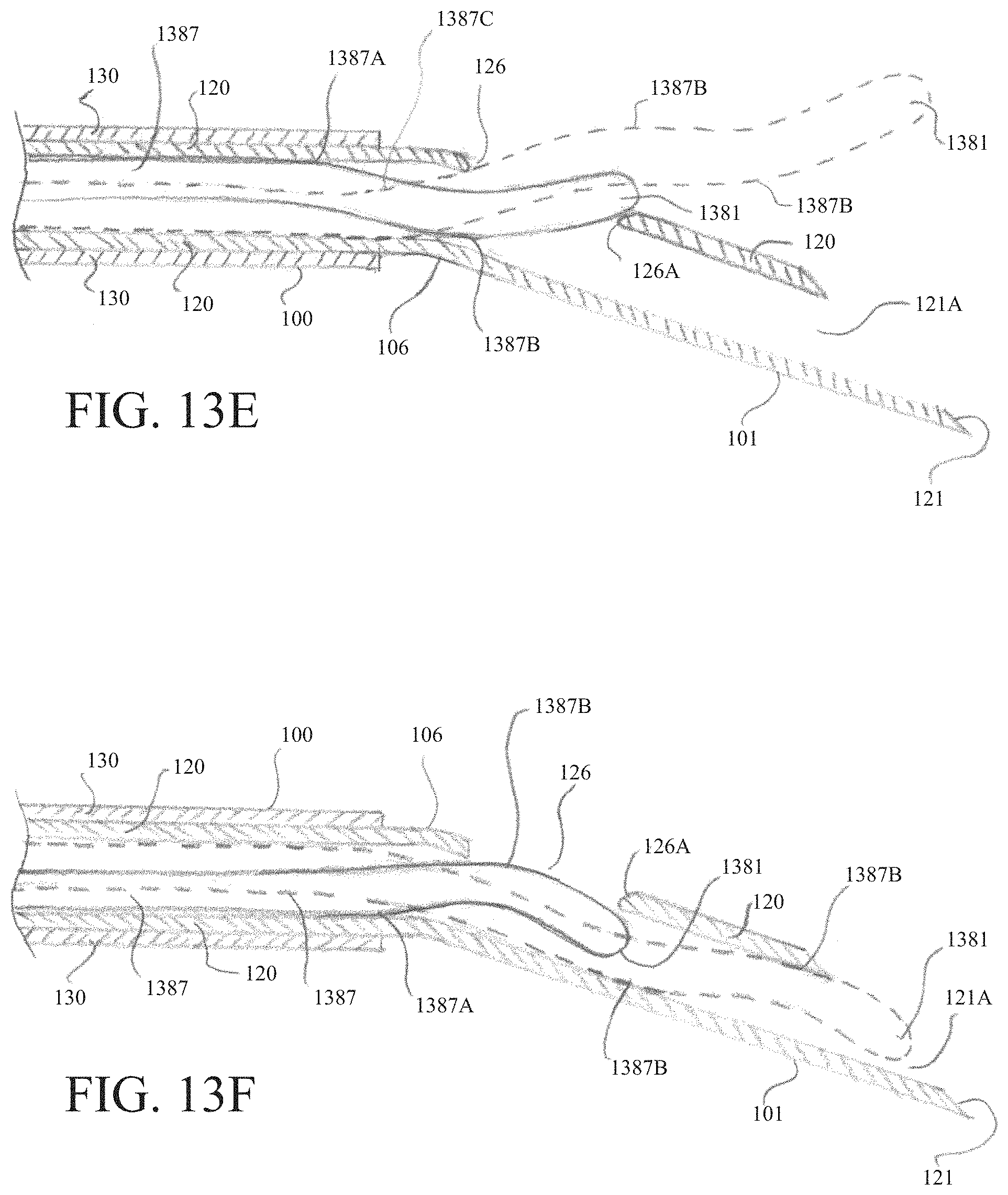 Patent US11793562 Figure 17 – Electrosurgical system