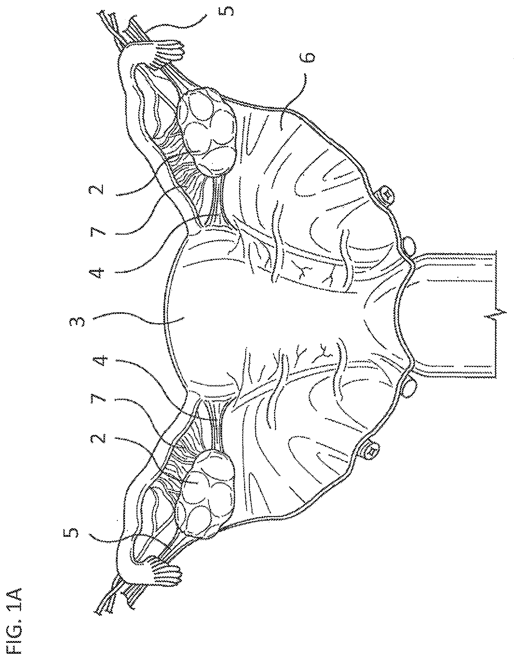 Patent US11793564 Figure 1 – Methods and systems for the treatment of polycystic ovary syndrome