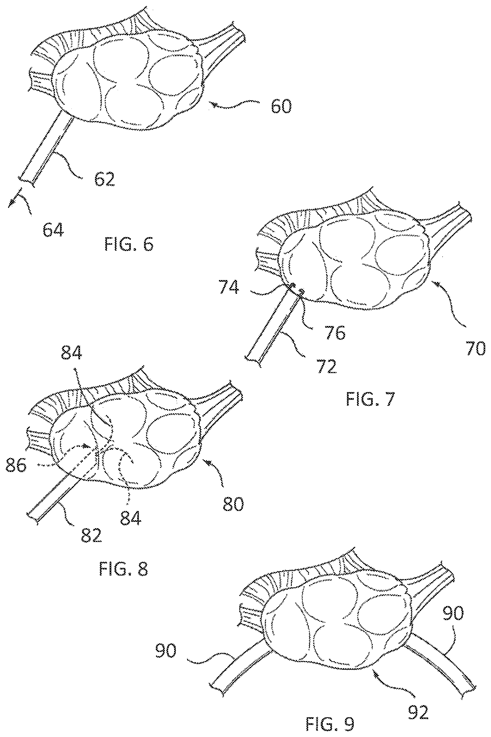 Patent US11793564 Figure 4 – Methods and systems for the treatment of polycystic ovary syndrome