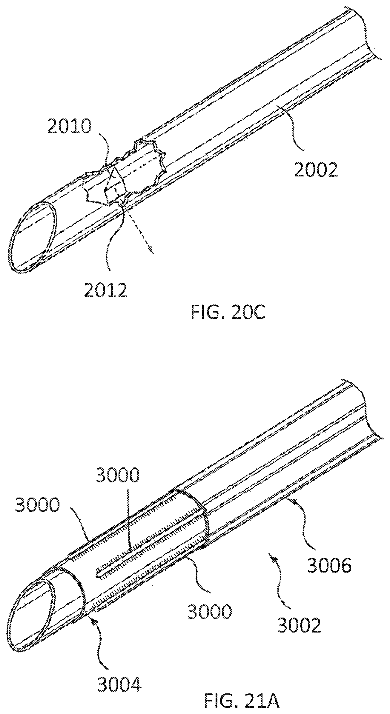 Patent US11793564 Figure 16 – Methods and systems for the treatment of polycystic ovary syndrome
