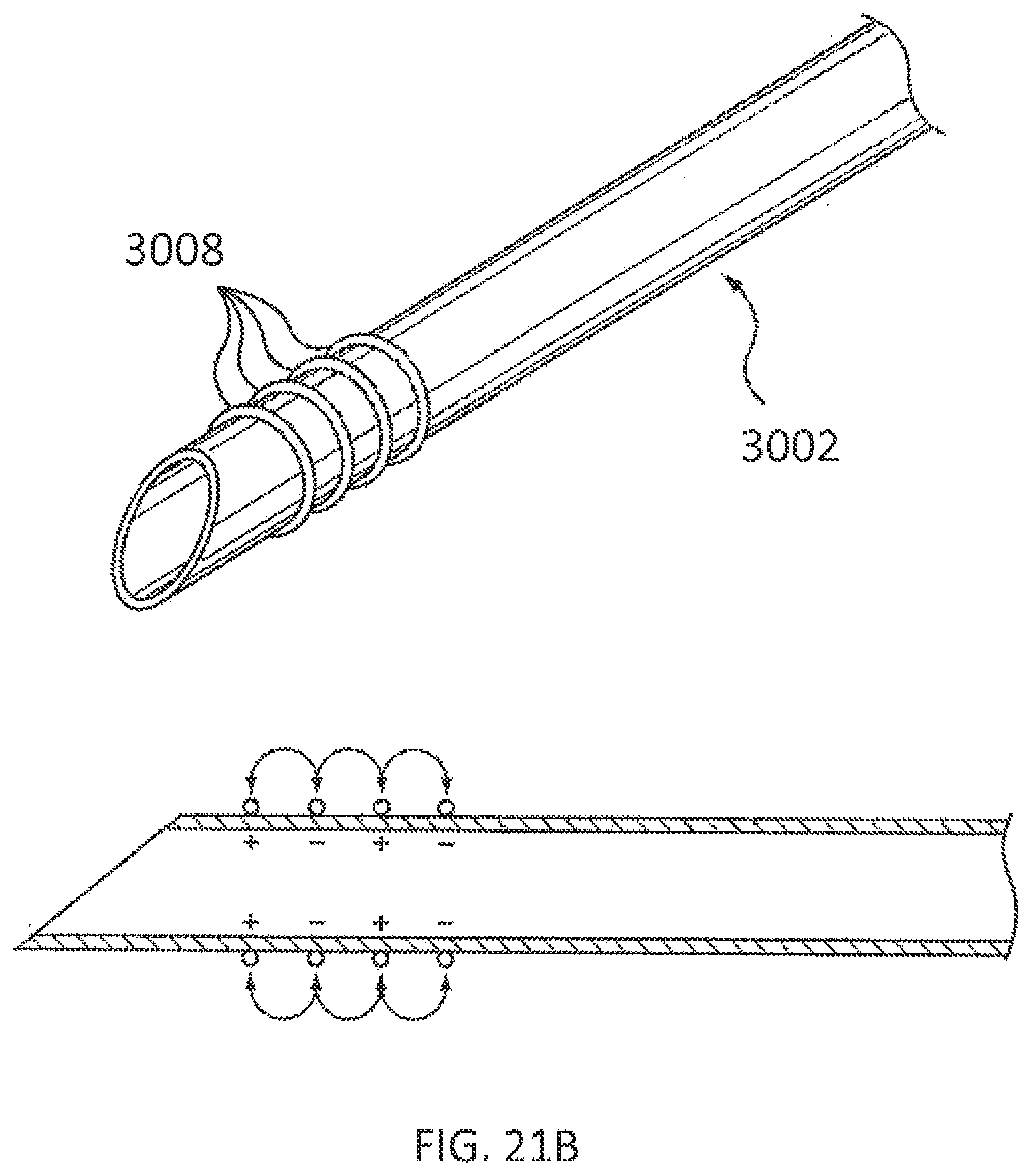 Patent US11793564 Figure 17 – Methods and systems for the treatment of polycystic ovary syndrome