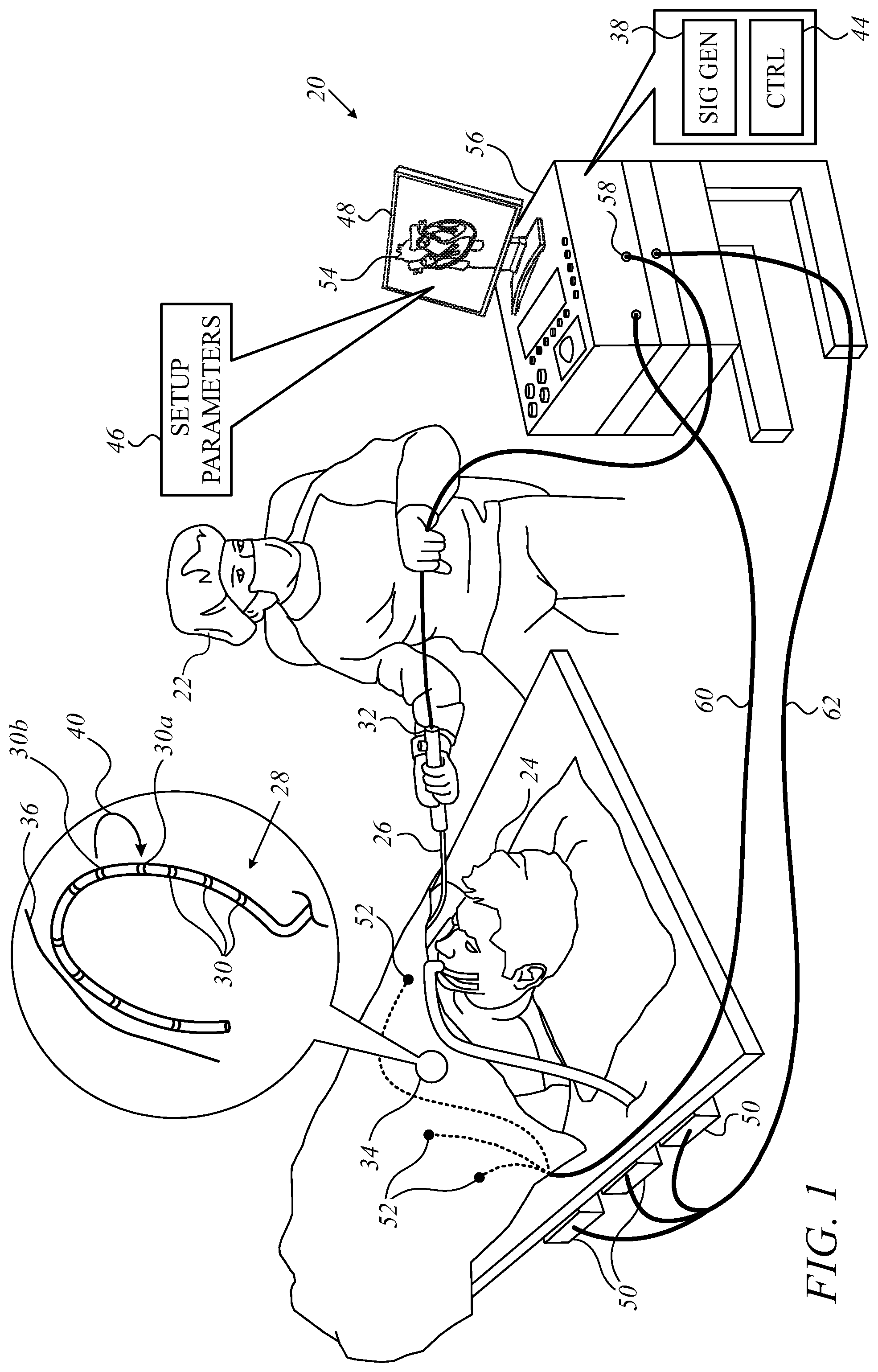 Patent US11793565 Figure 1 – Detecting electrode contact using absolute and relative thresholds