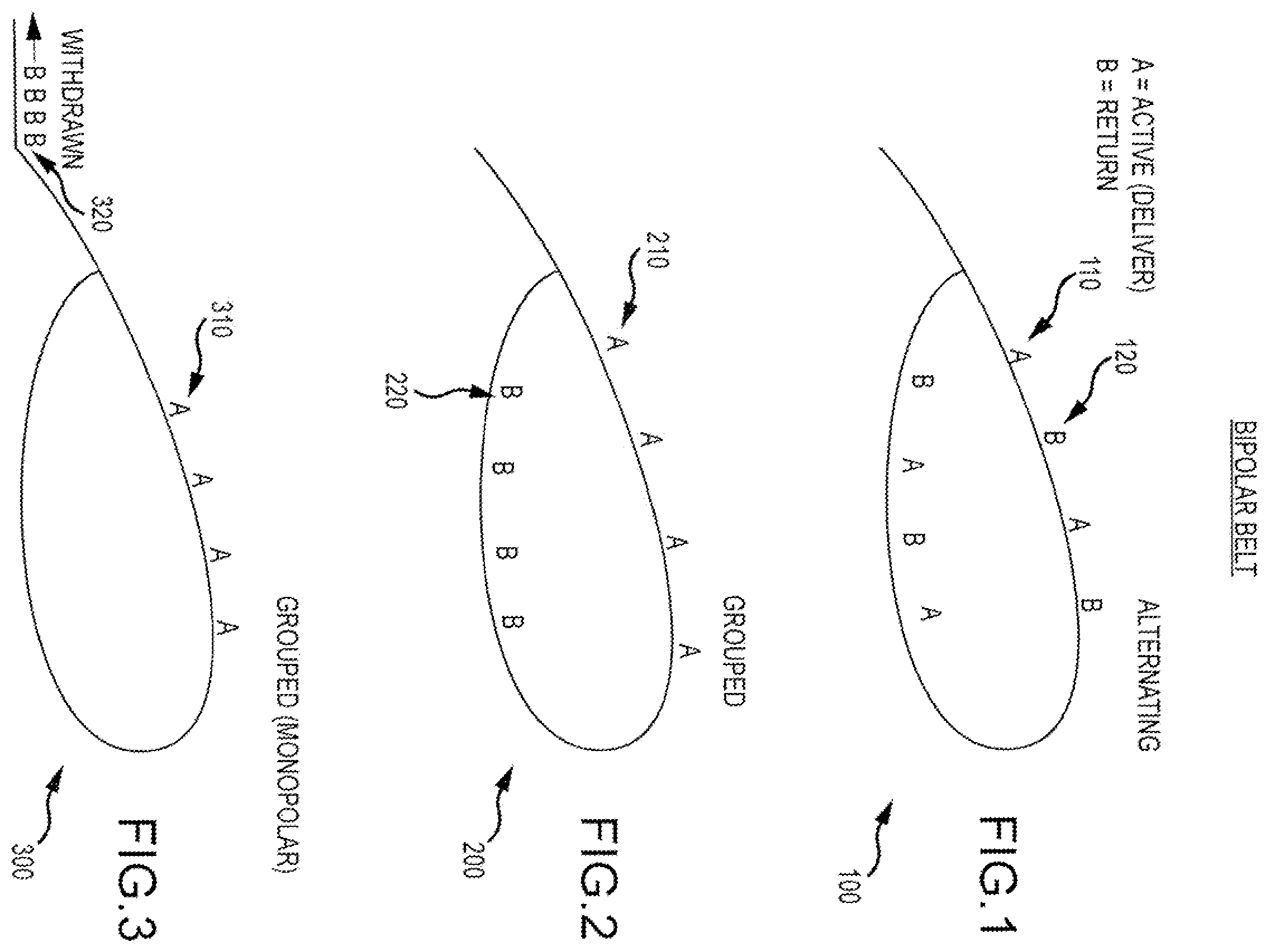 Patent US11793568 — Bipolar belt systems and methods — Figure 1