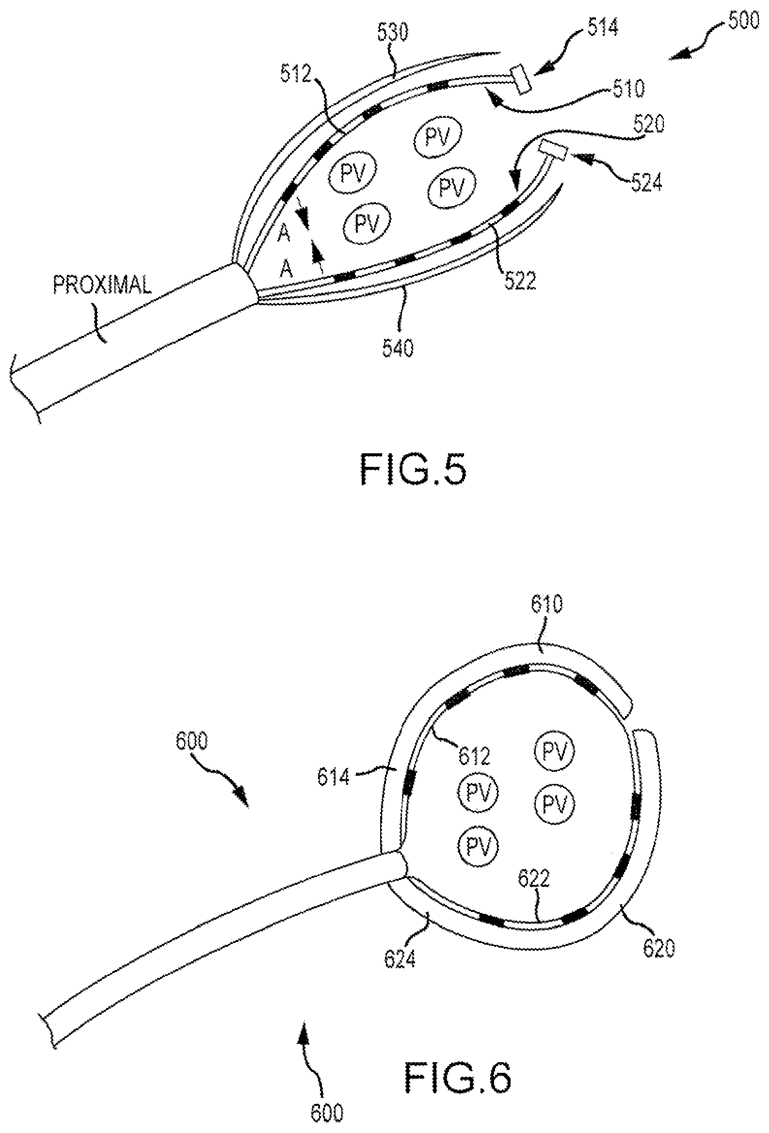 Patent US11793568 Figure 3 – Bipolar belt systems and methods
