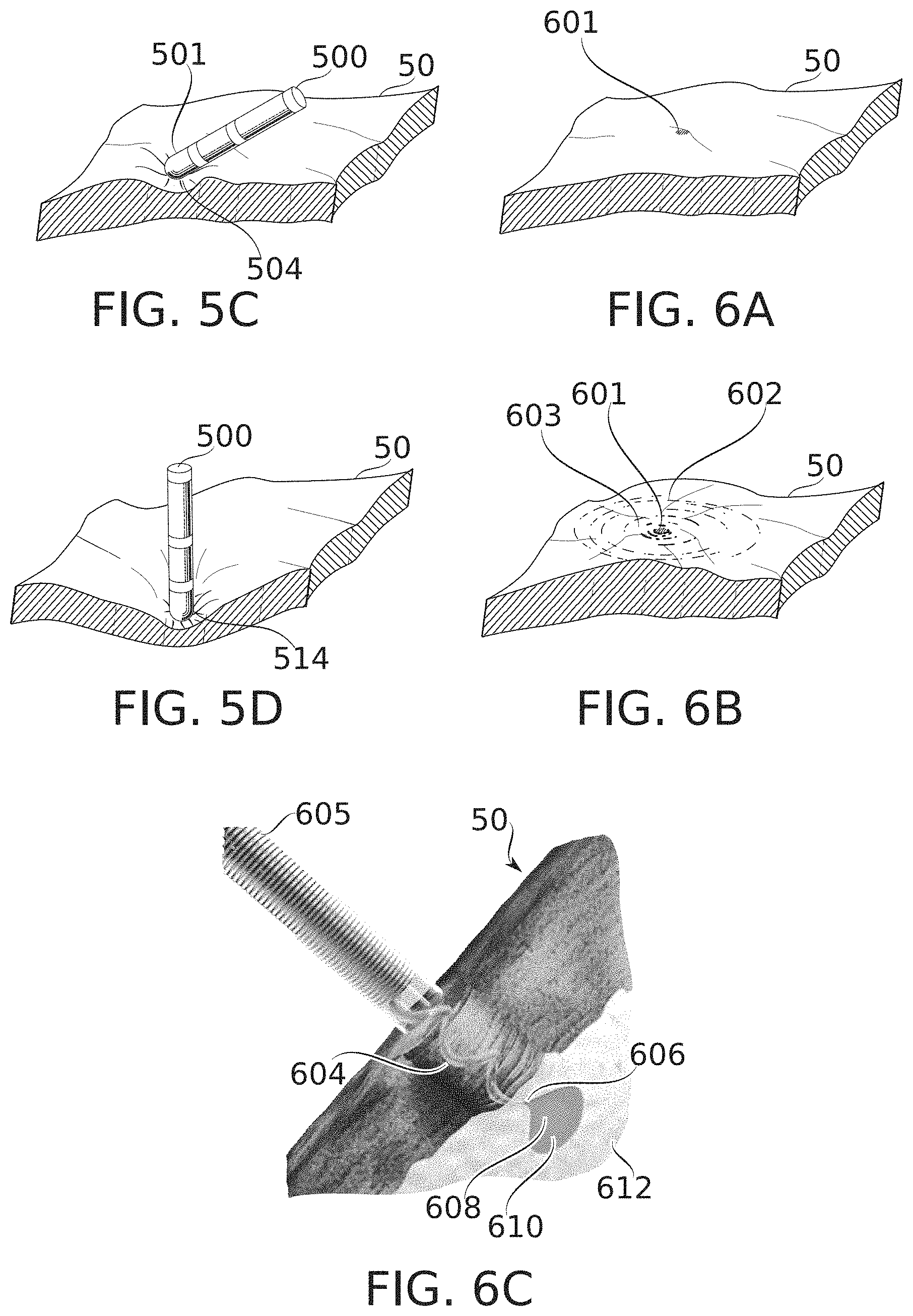 Patent US11793571 Figure 7 – Real-time display of treatment-related tissue changes using virtual material