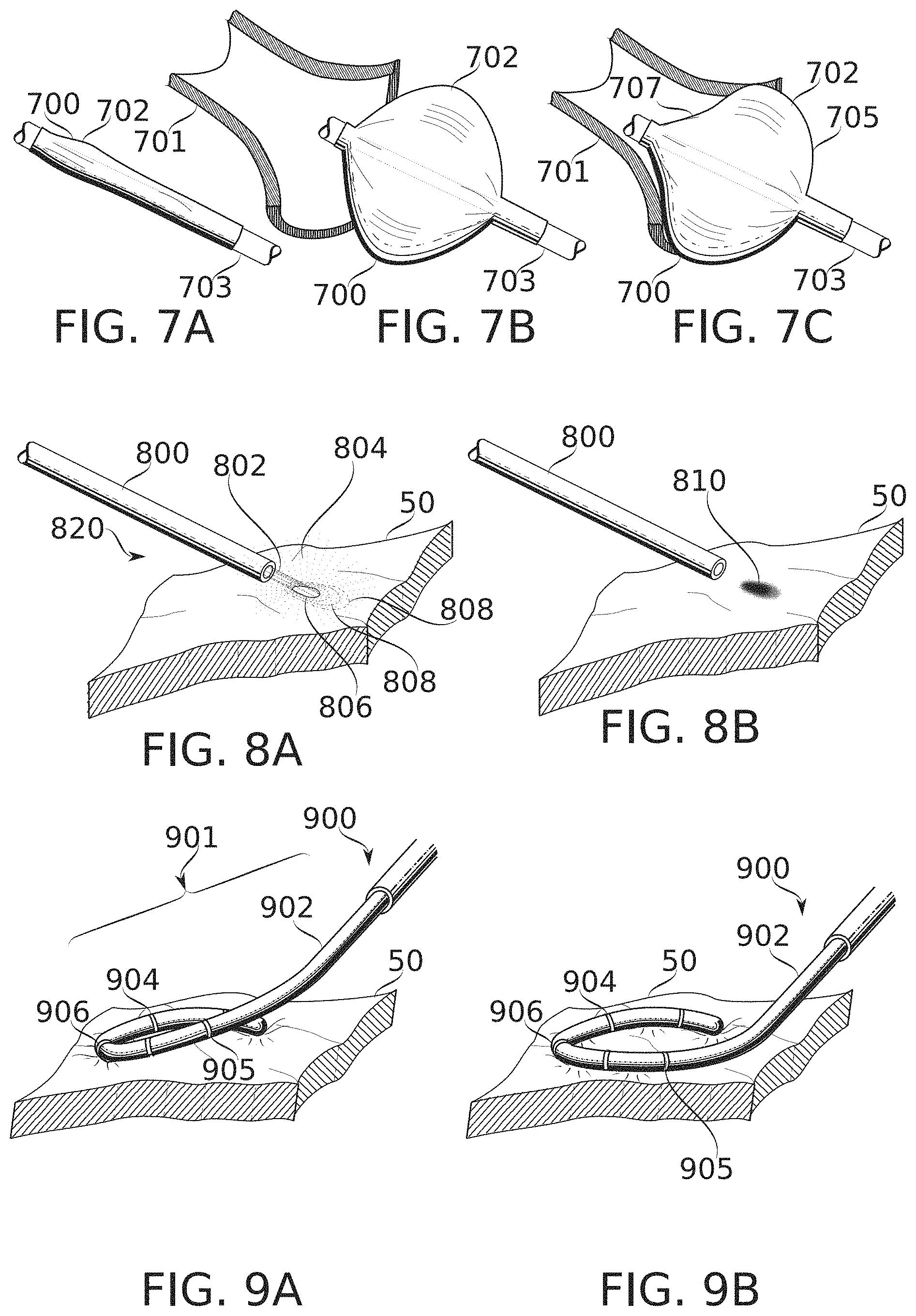 Patent US11793571 Figure 8 – Real-time display of treatment-related tissue changes using virtual material