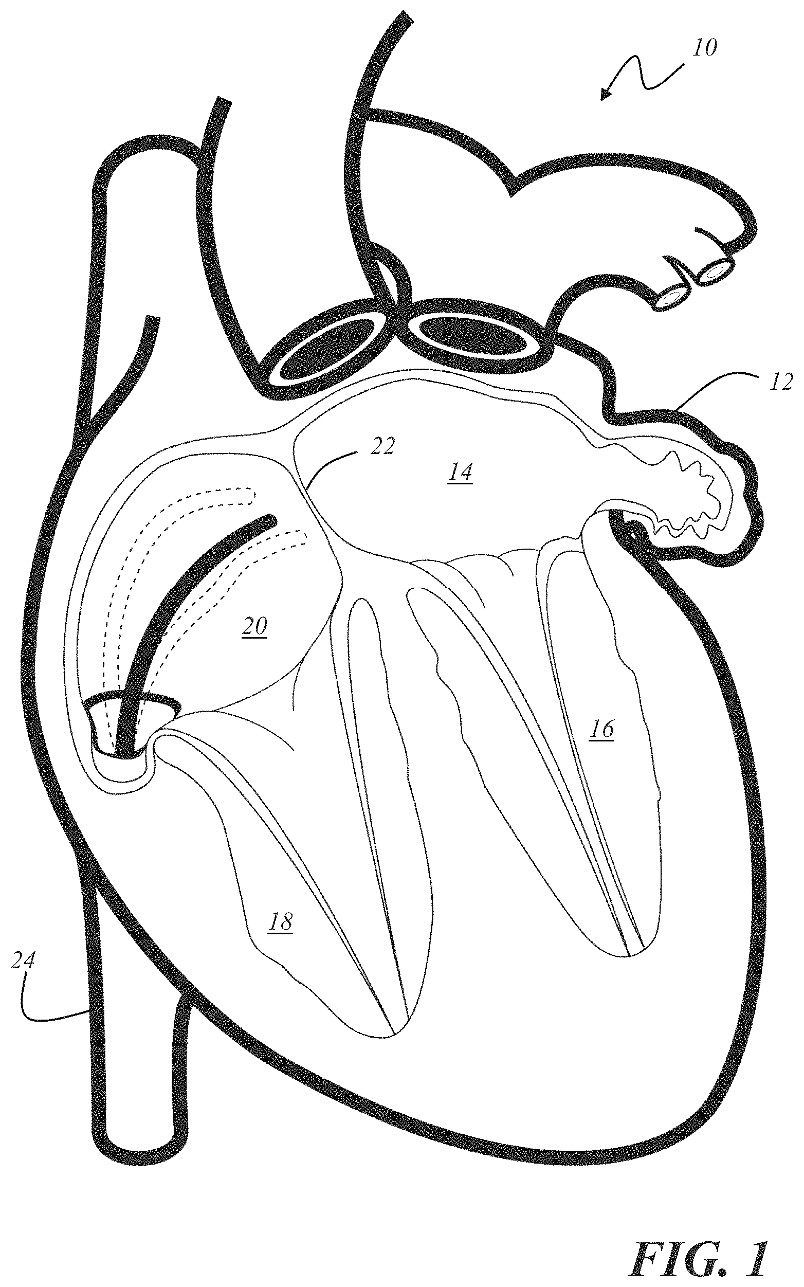 Patent US11793572 Figure 1 – Selecting a medical device for use in a medical procedure