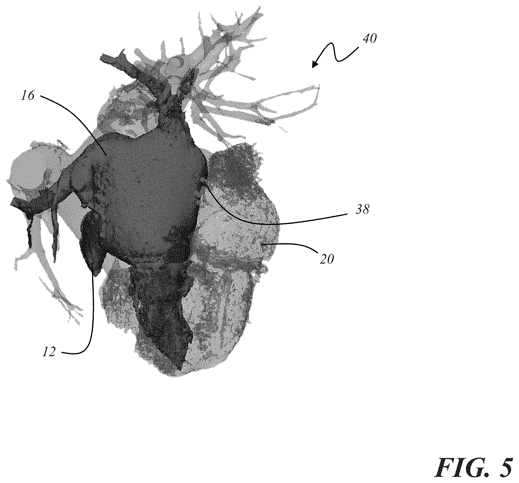 Patent US11793572 Figure 5 – Selecting a medical device for use in a medical procedure