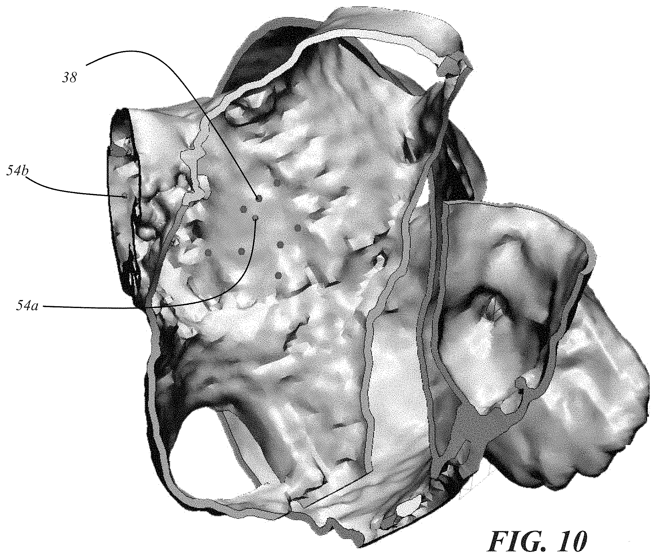 Patent US11793572 Figure 10 – Selecting a medical device for use in a medical procedure