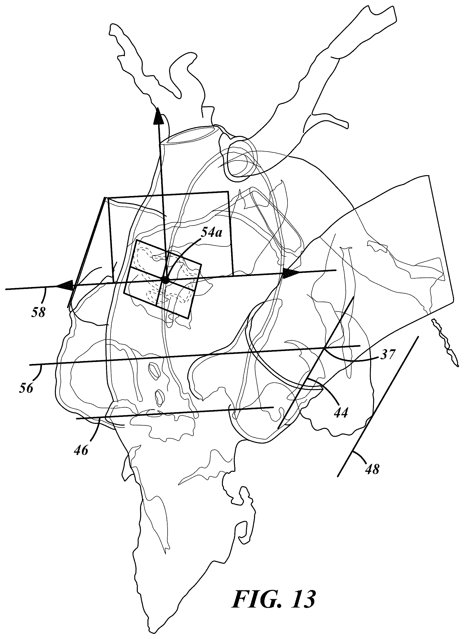 Patent US11793572 Figure 13 – Selecting a medical device for use in a medical procedure